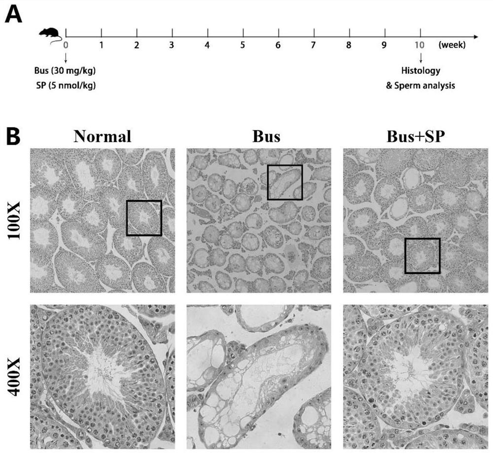 Use of sp in the preparation of medicines for treating male infertility