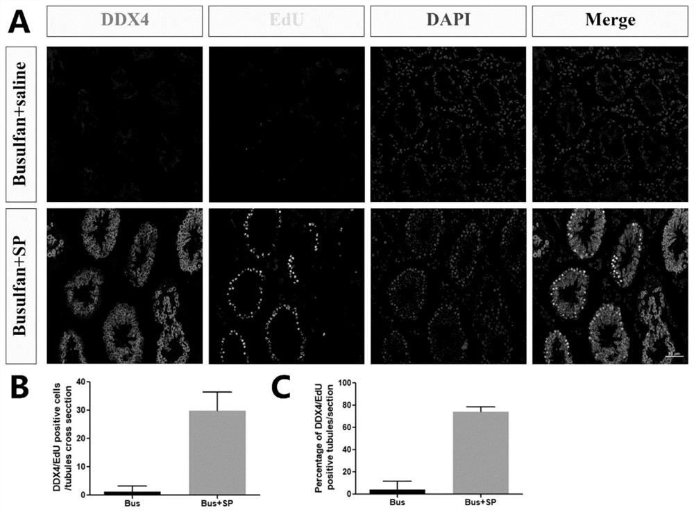 Use of sp in the preparation of medicines for treating male infertility