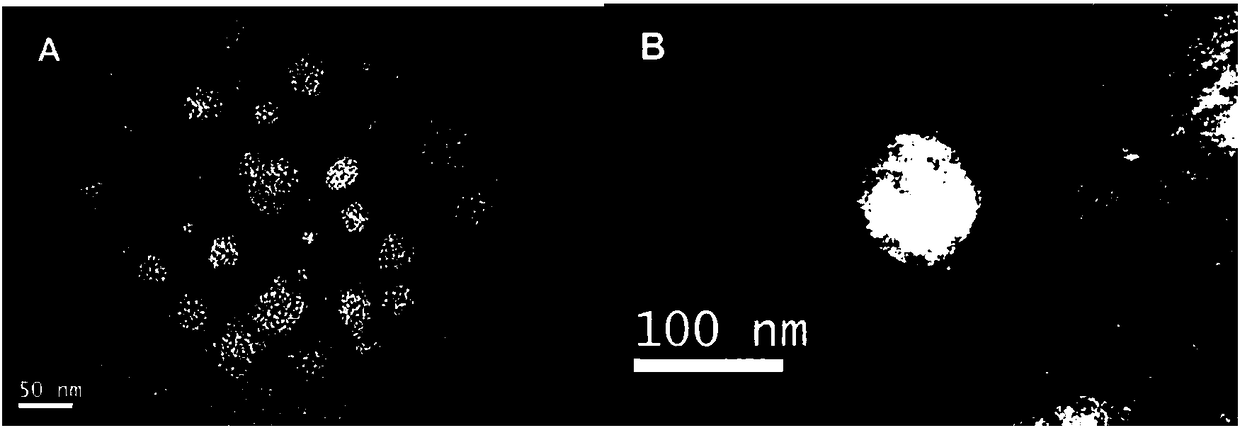 Preparation method of red blood cell membrane-coated gelatin-loaded berberine hydrochloride gold nanoparticles and application thereof