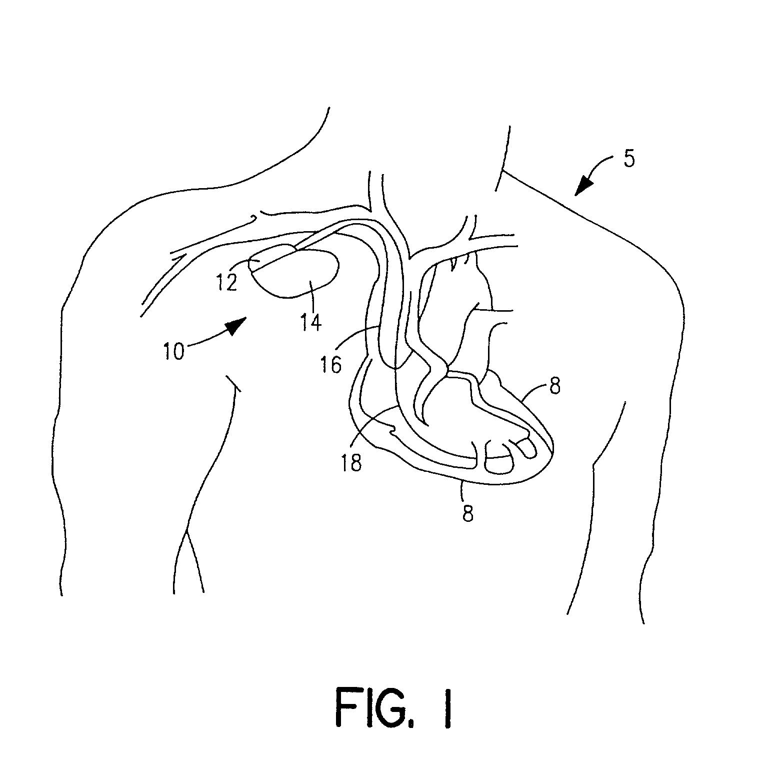 System and method of automated invoicing for communications between an implantable medical device and a remote computer system or health care provider