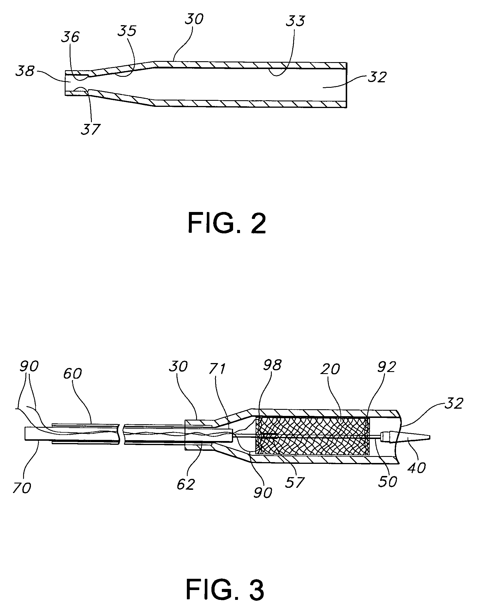 Apparatus and method for loading and delivering a stent using a suture retaining mechanism