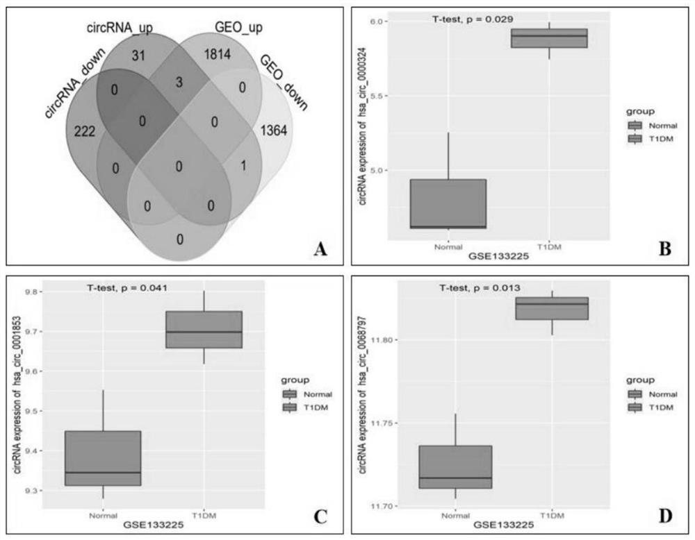 Biomarker for regulating CD4 + T cell differentiation and proliferation of type 1 diabetes mellitus and application thereof