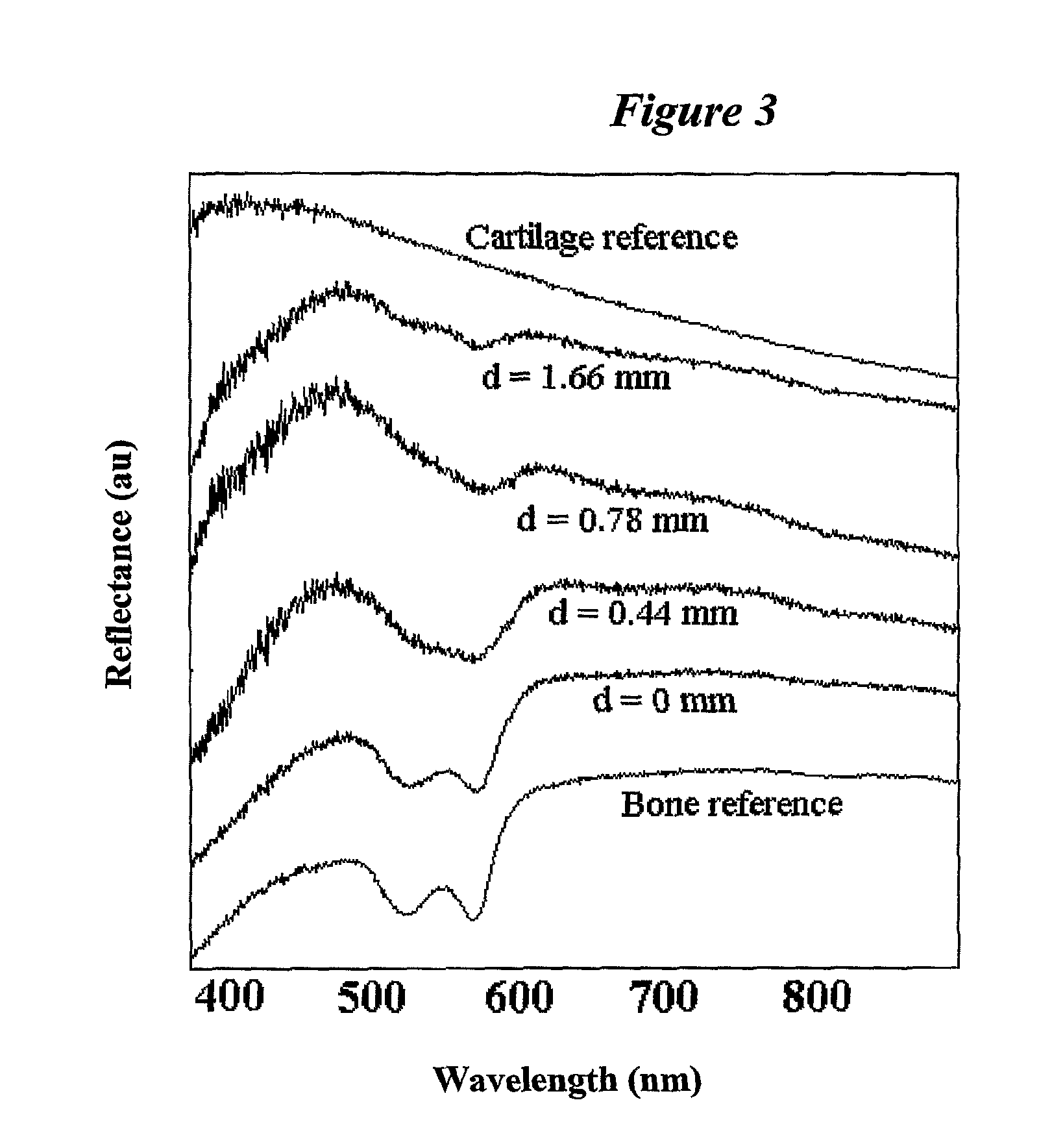 Arrangement and method for assessing tissue qualities