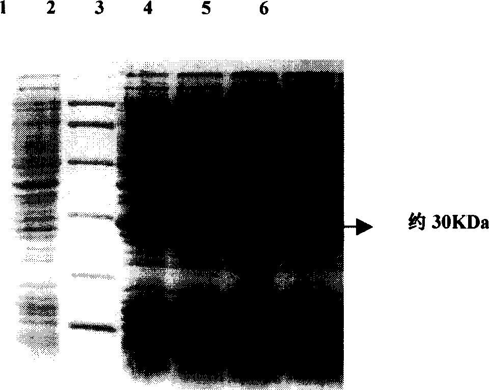 Expression of P27 protein and its use