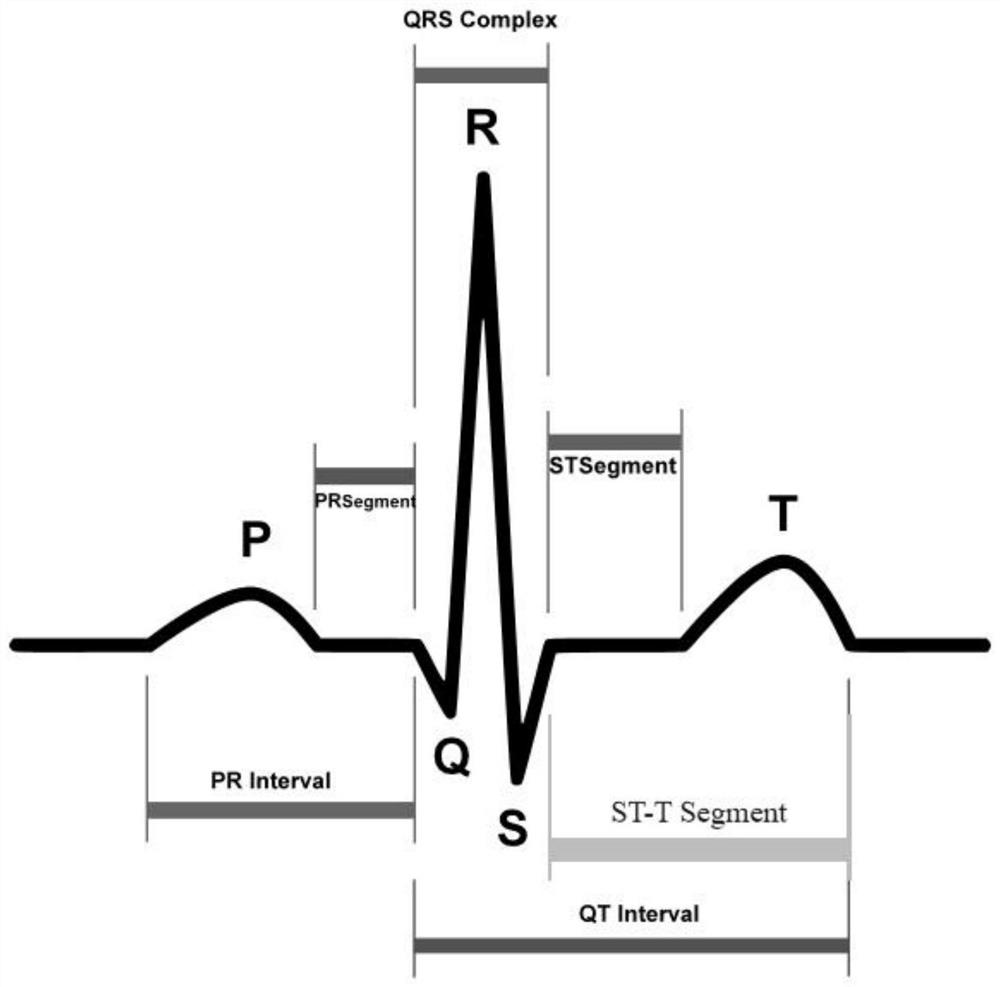 Electrocardiosignal premature beat detection method for