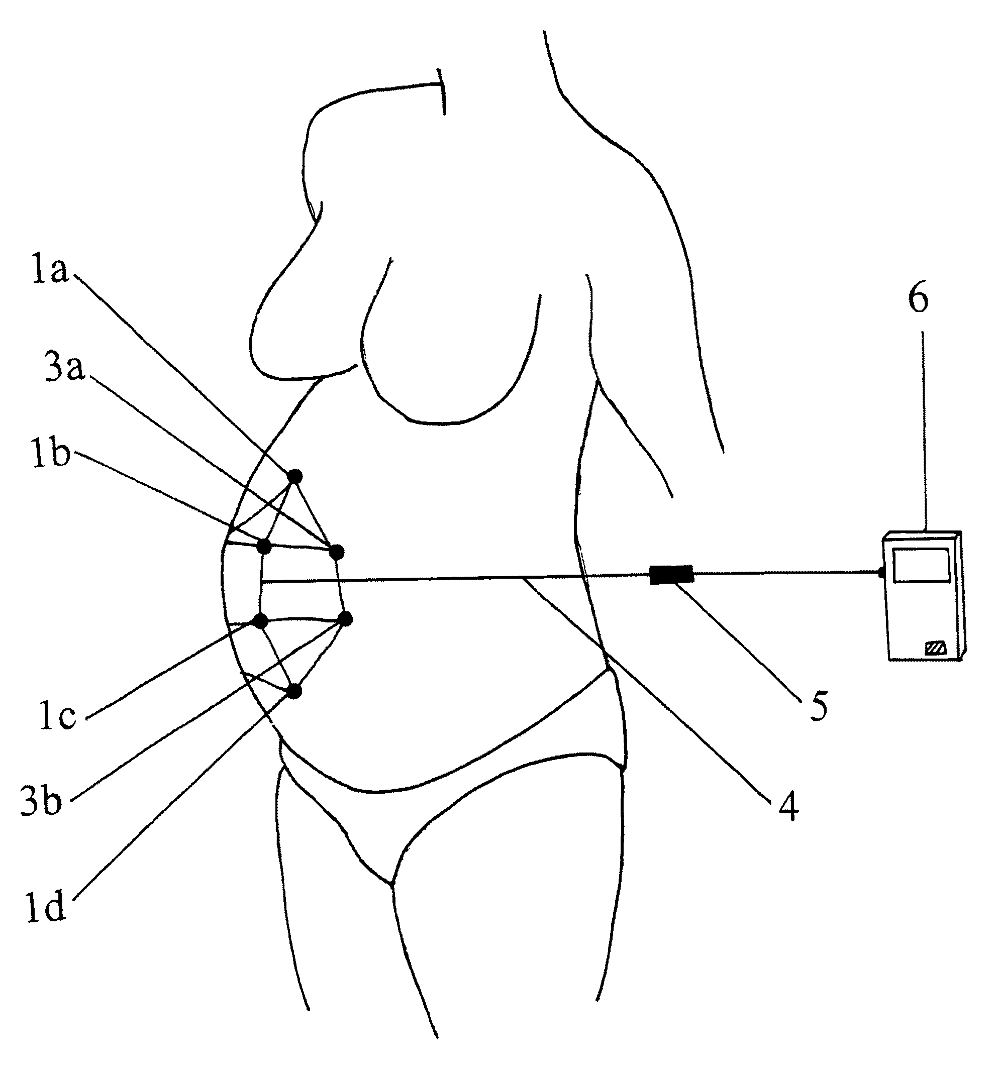 Obstetric analgesia system