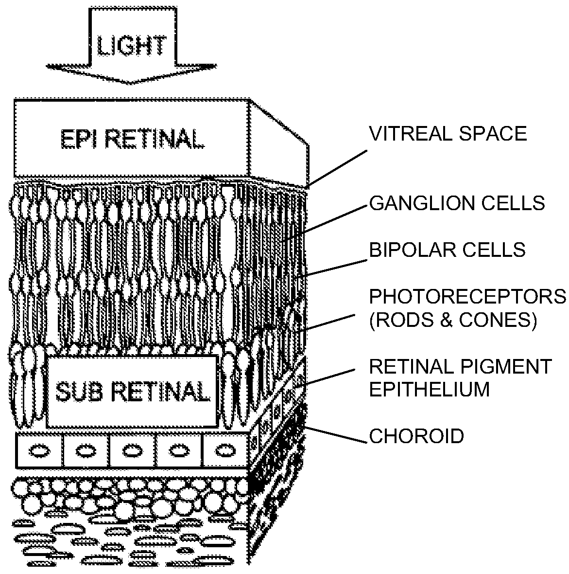 Ultra-high photosensitivity vertical nanowire arrays for retinal prosthesis