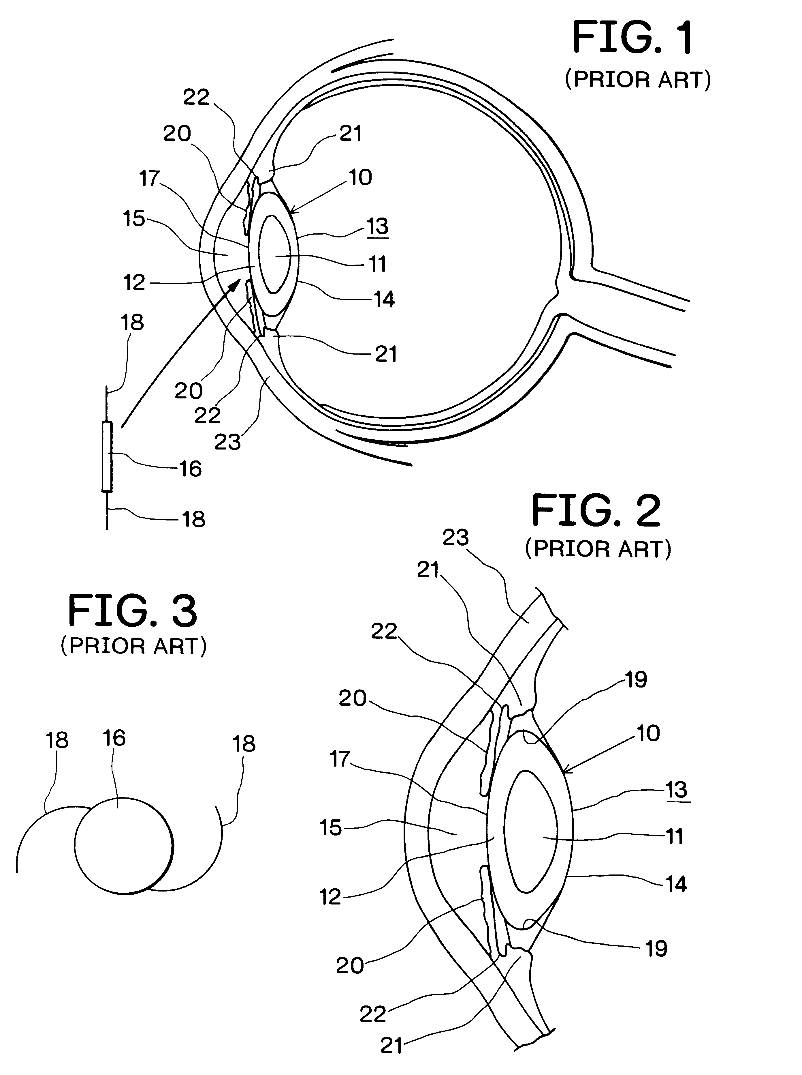 Intraocular lens insertion device