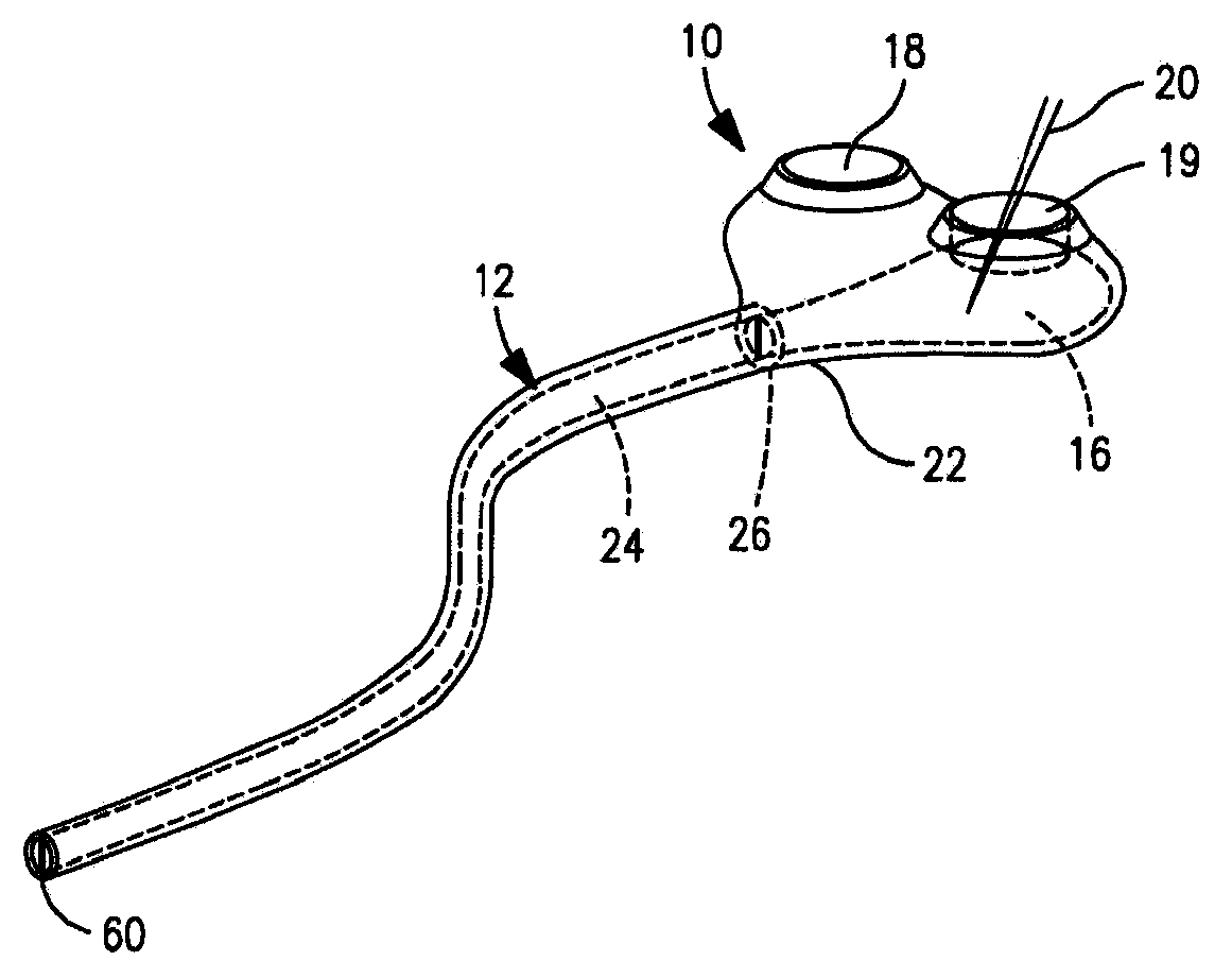 Implantable catheter port