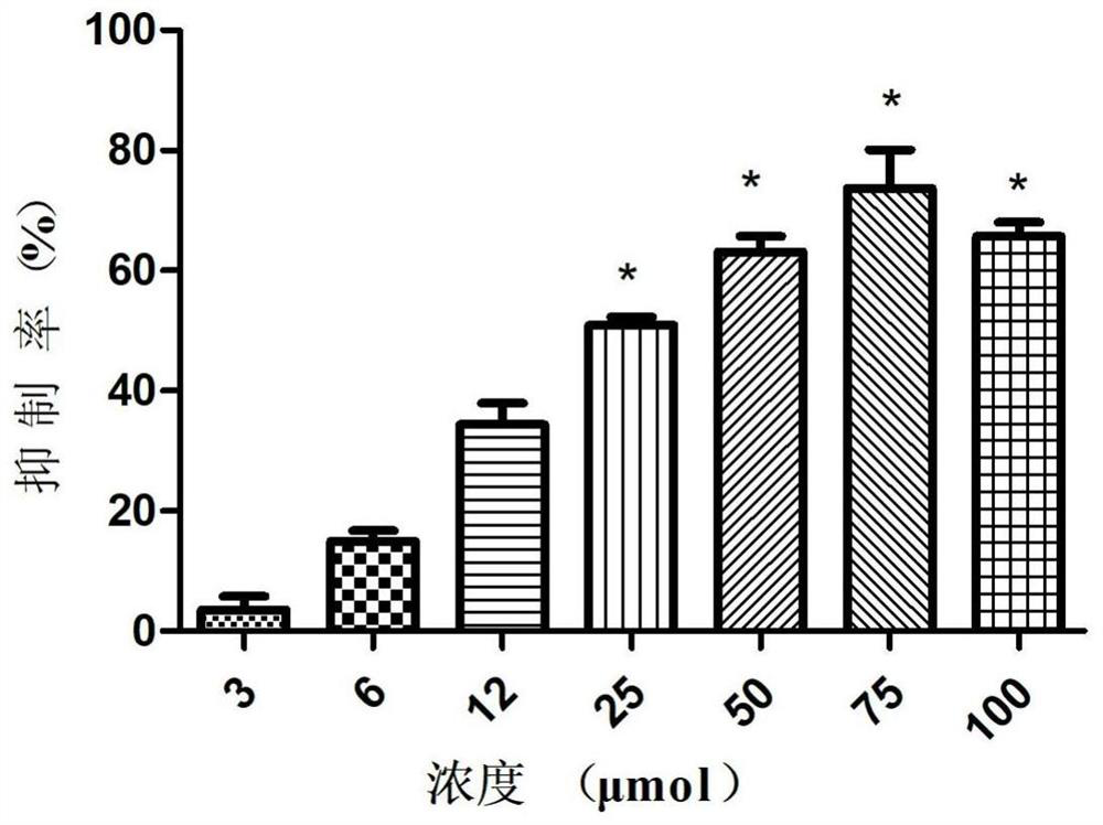 Application of a kind of buquinal in preparation of medicine for preventing foot-and-mouth disease virus infection