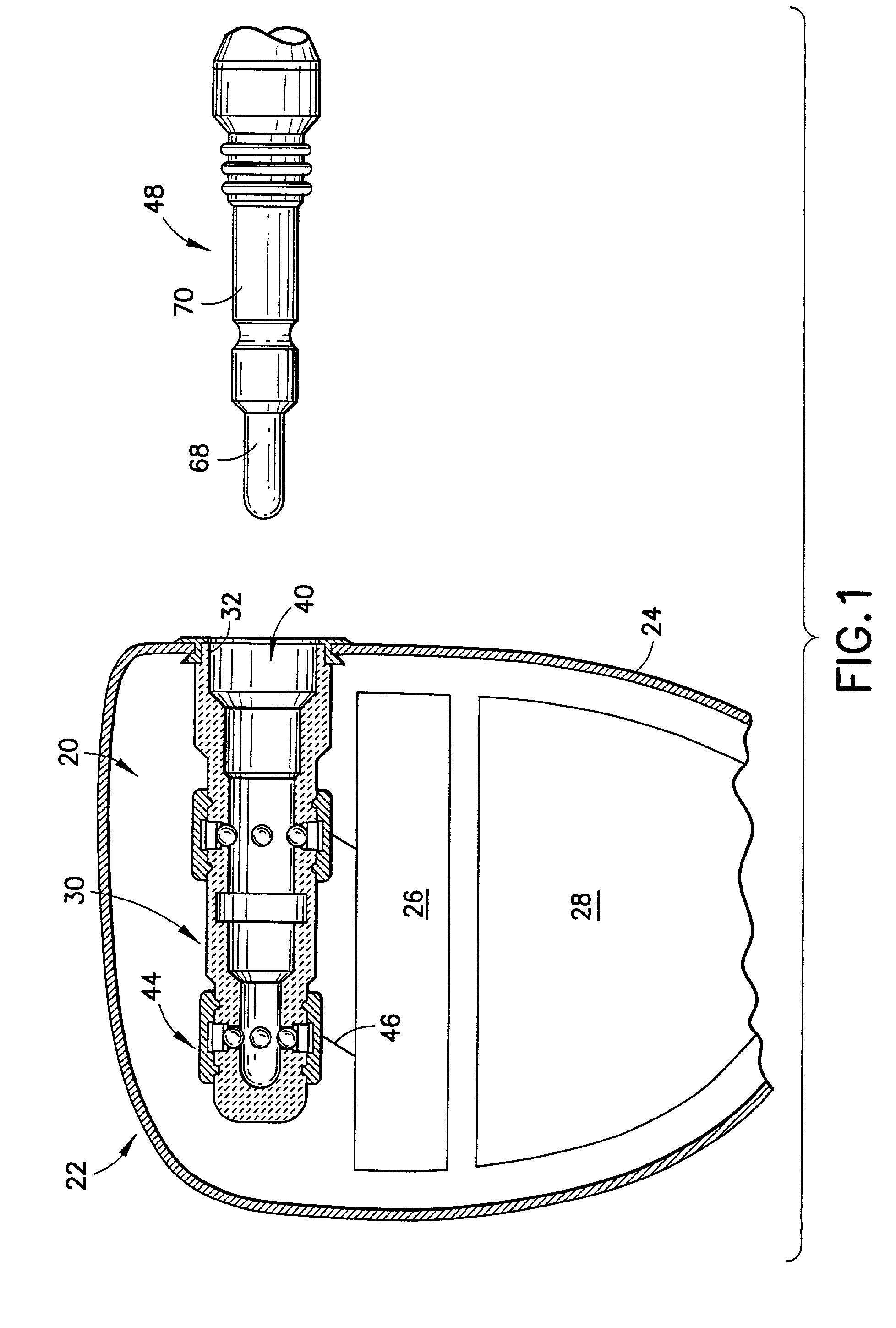 Hermetically sealed feedthrough connector using shape memory alloy for implantable medical device