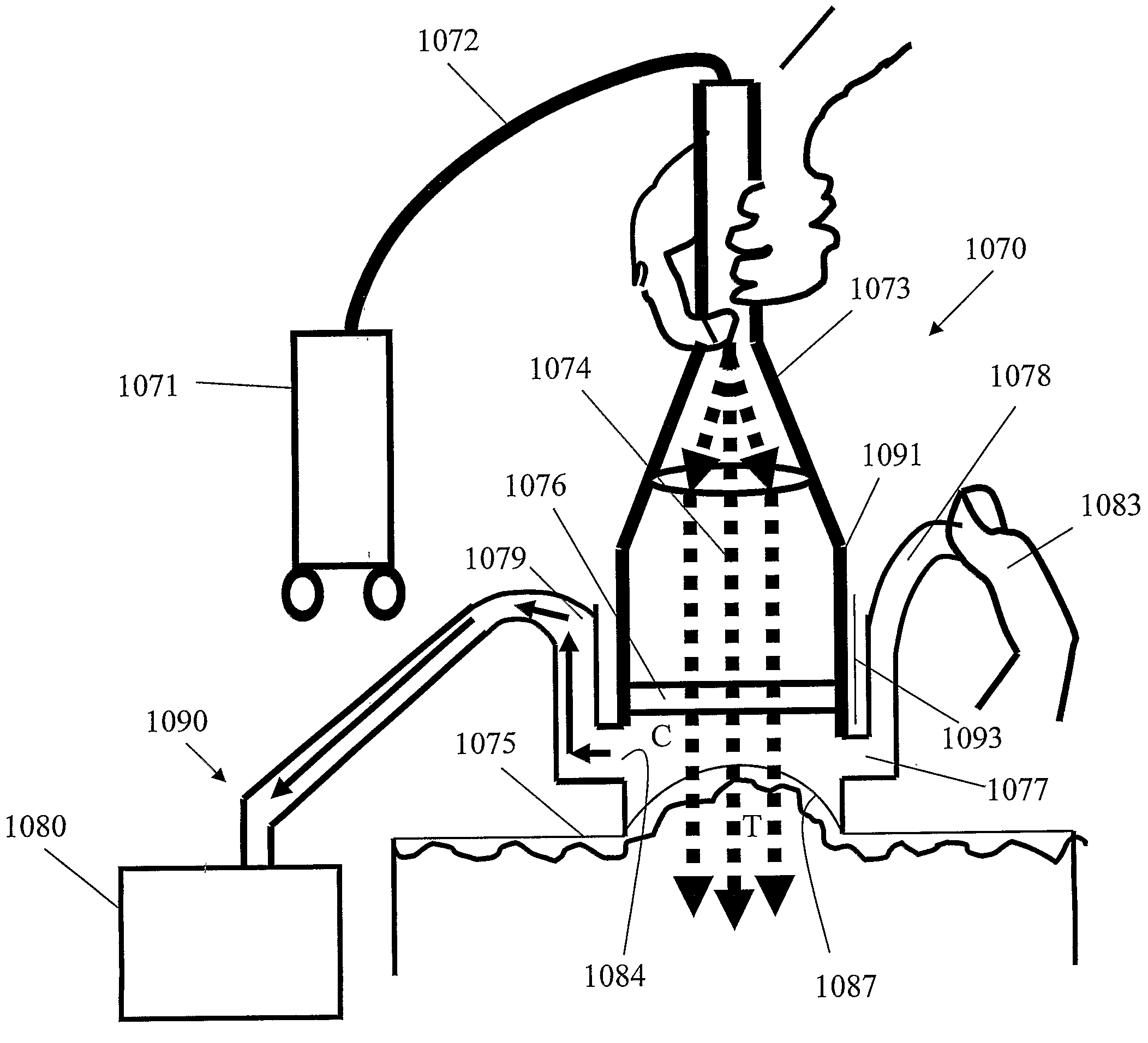 Method and Apparatus for Inhibiting Pain Signals During Vacuum-Assisted Medical Treatments of the Skin