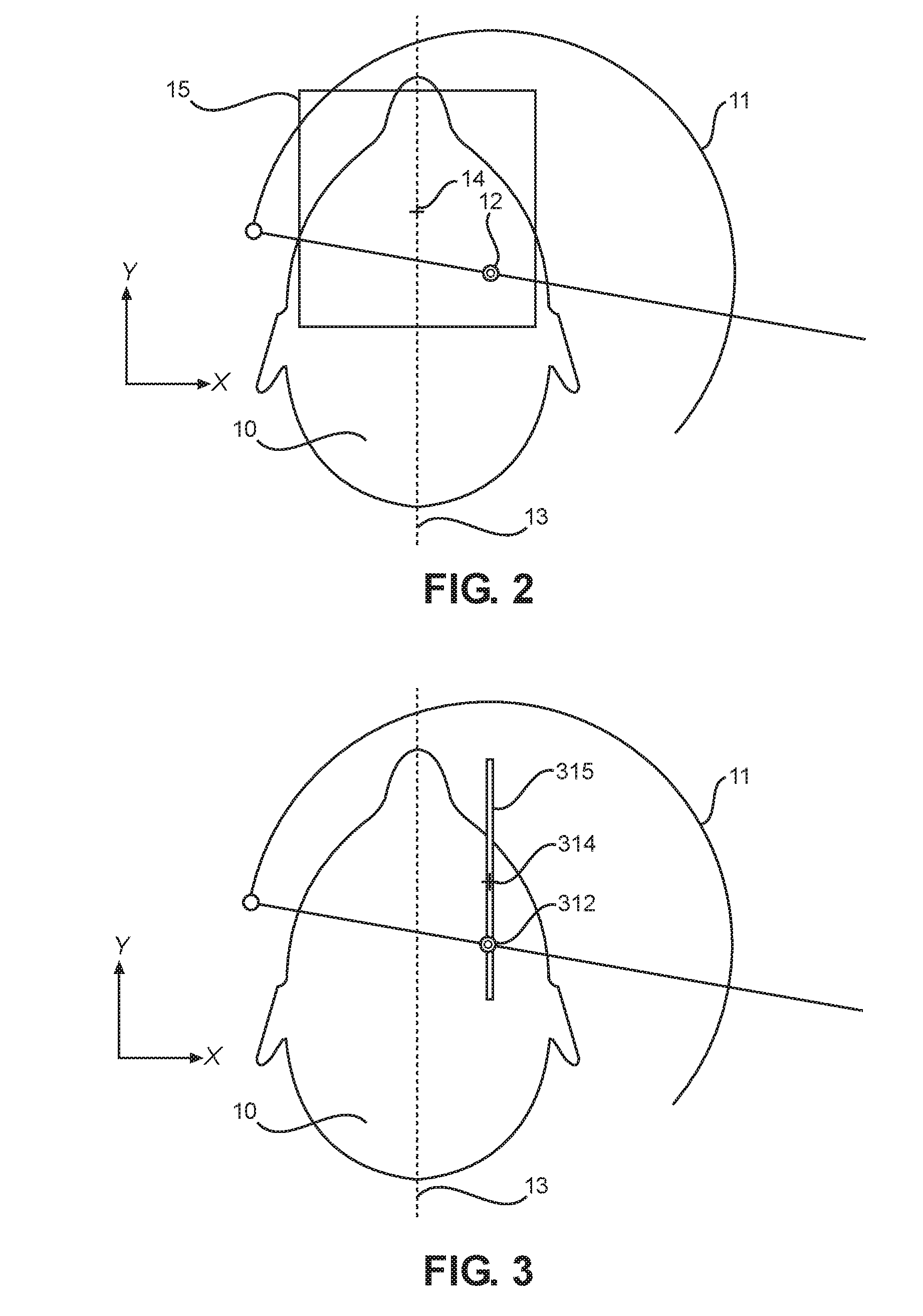 Method and apparatus for acquiring panoramic and CBCT volumetric radiographies