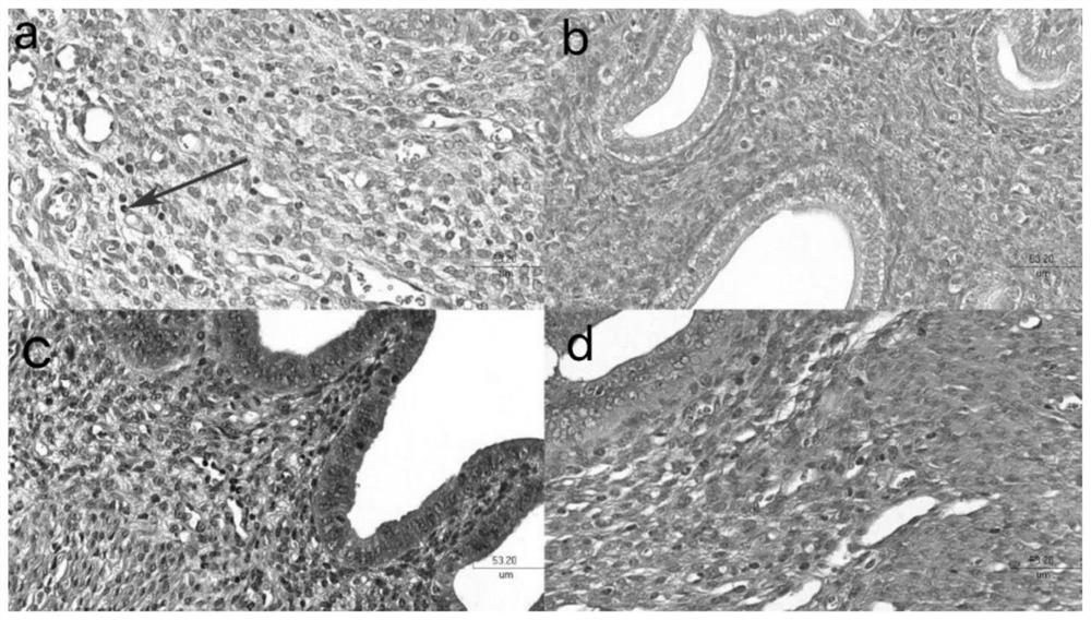 Application of chlamydia protein Pgp3 in preparation of medicine for inhibiting salpingitis