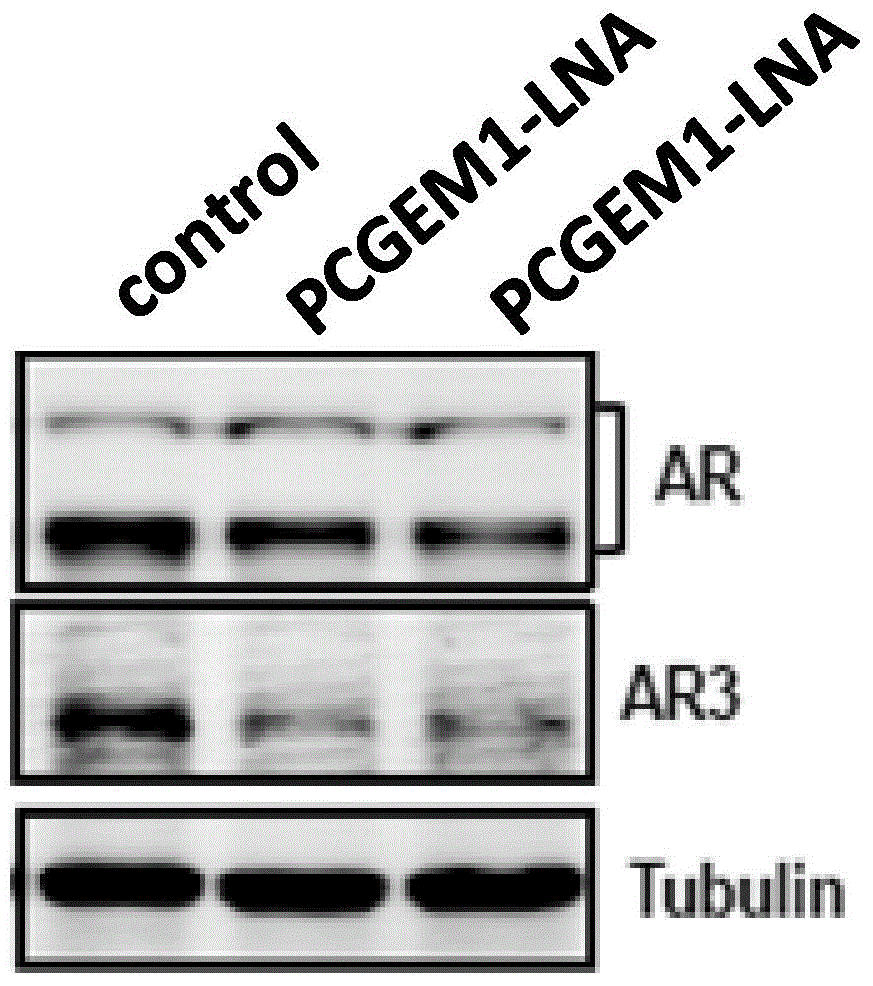 In-vitro mini-reporter gene used for predicating androgen receptor posttranscriptional modification sites and application thereof