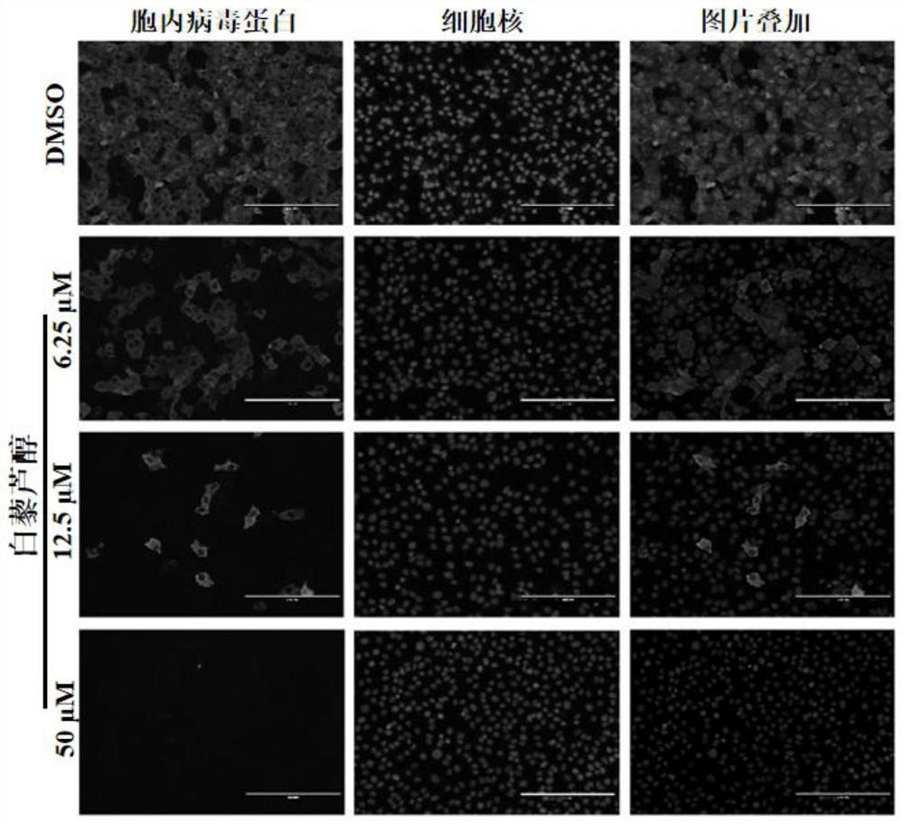 Anti-novel coronavirus drug and application thereof