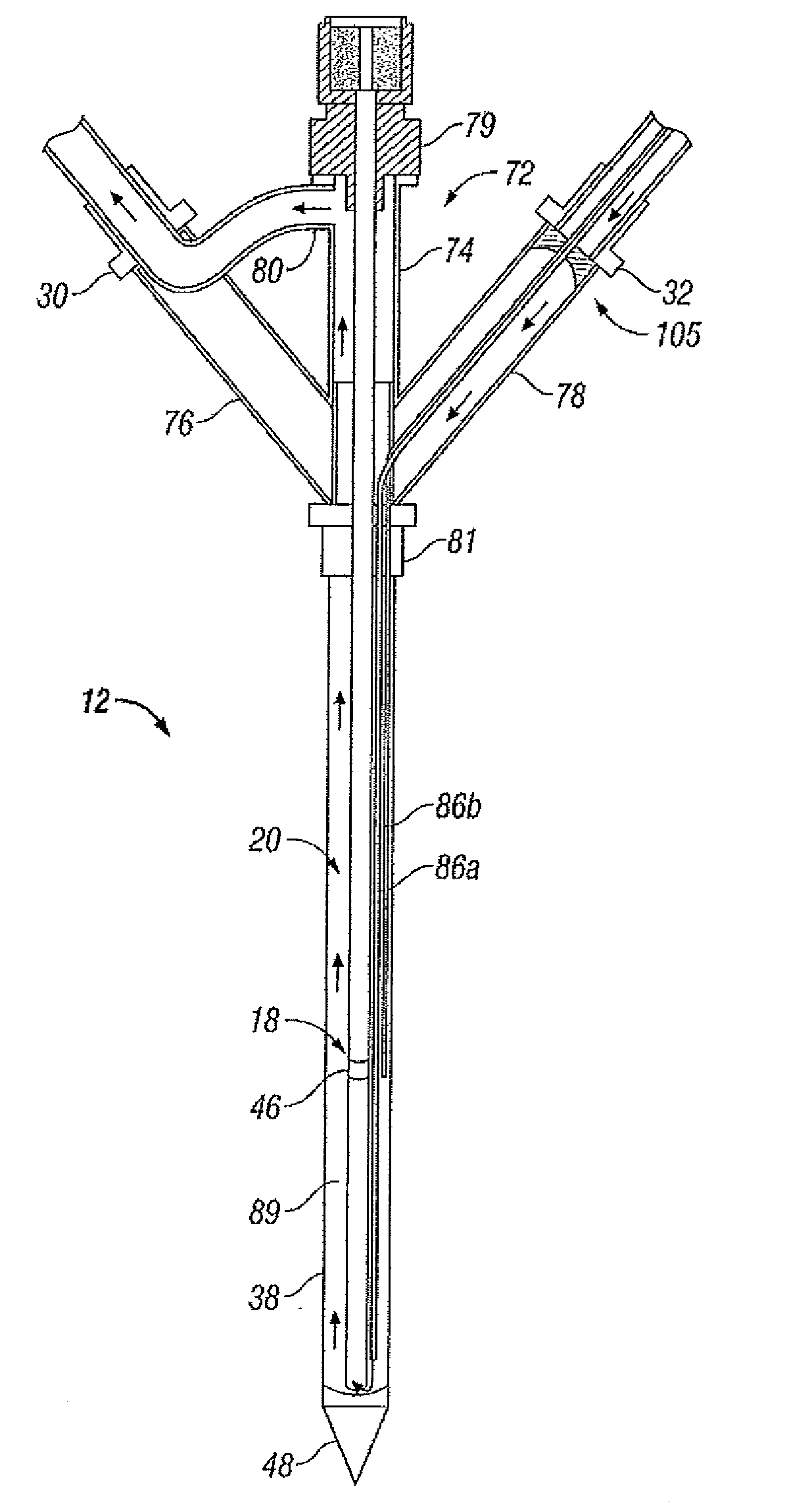 System and Method for Performing an Ablation Procedure