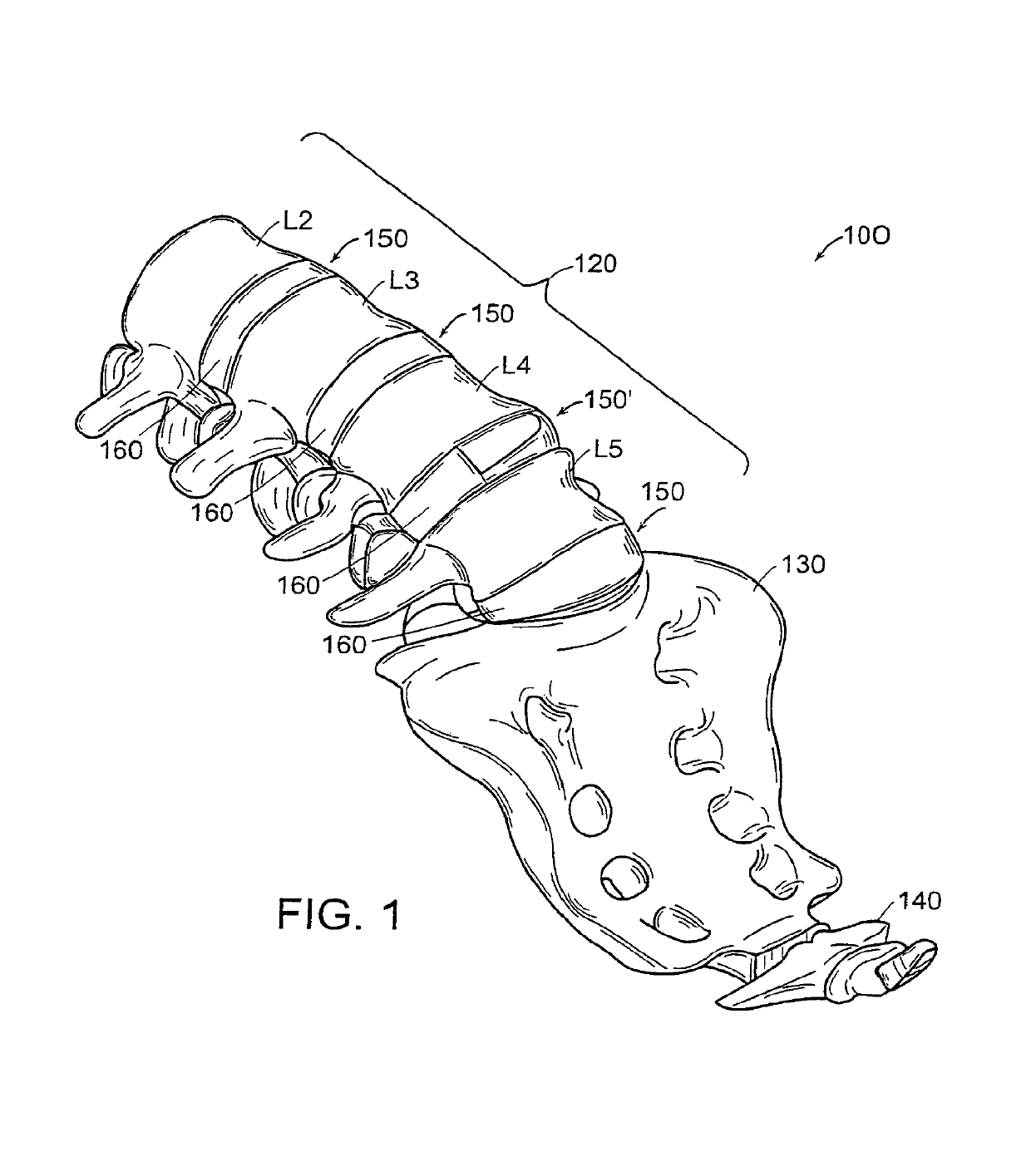 Intervertebral implant with conformable endplate