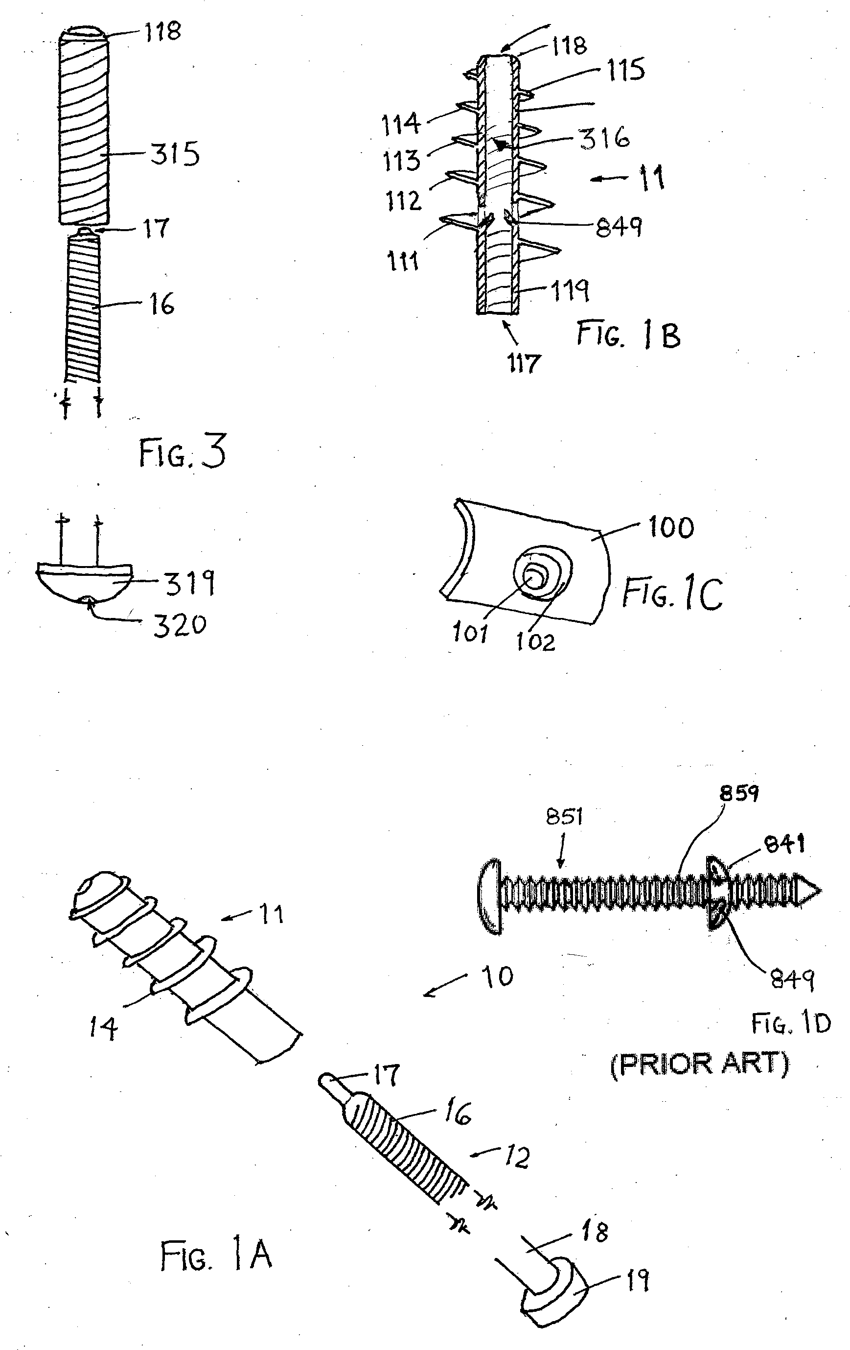 Screw and method of use