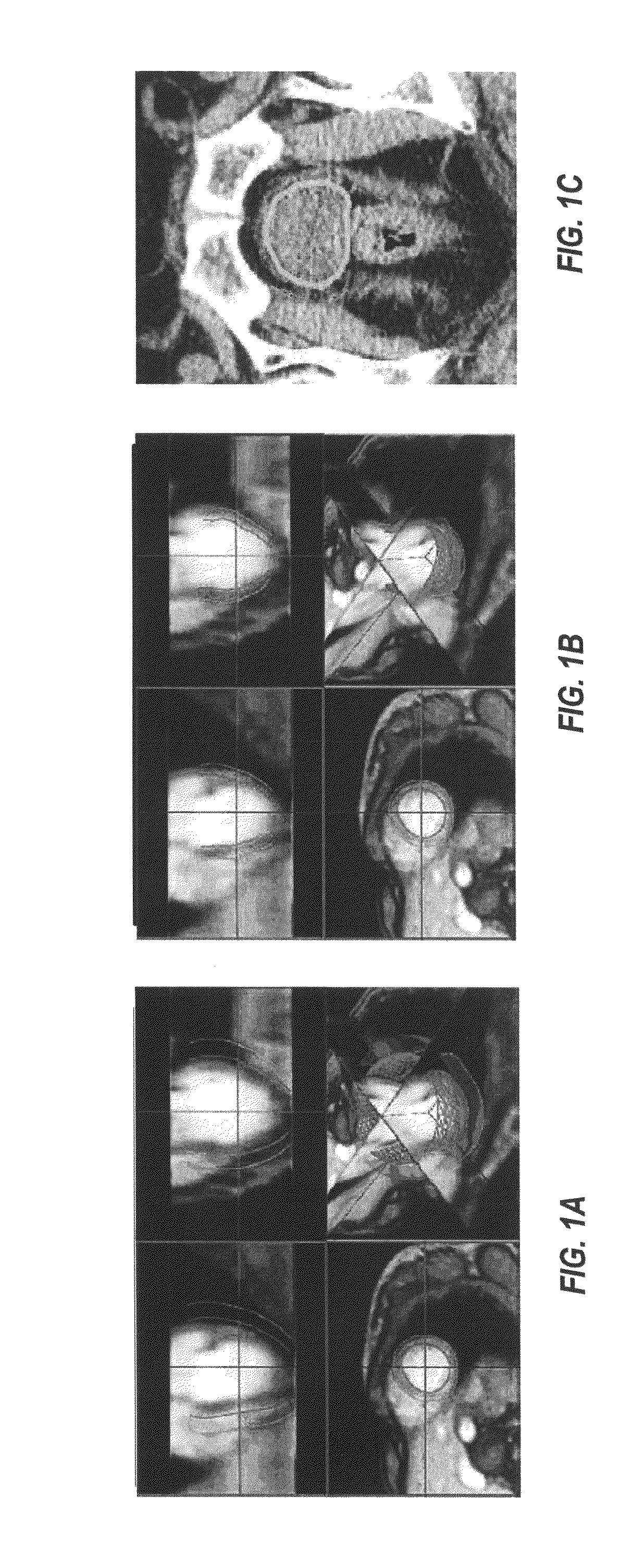 System and methods for multi-object multi-surface segmentation