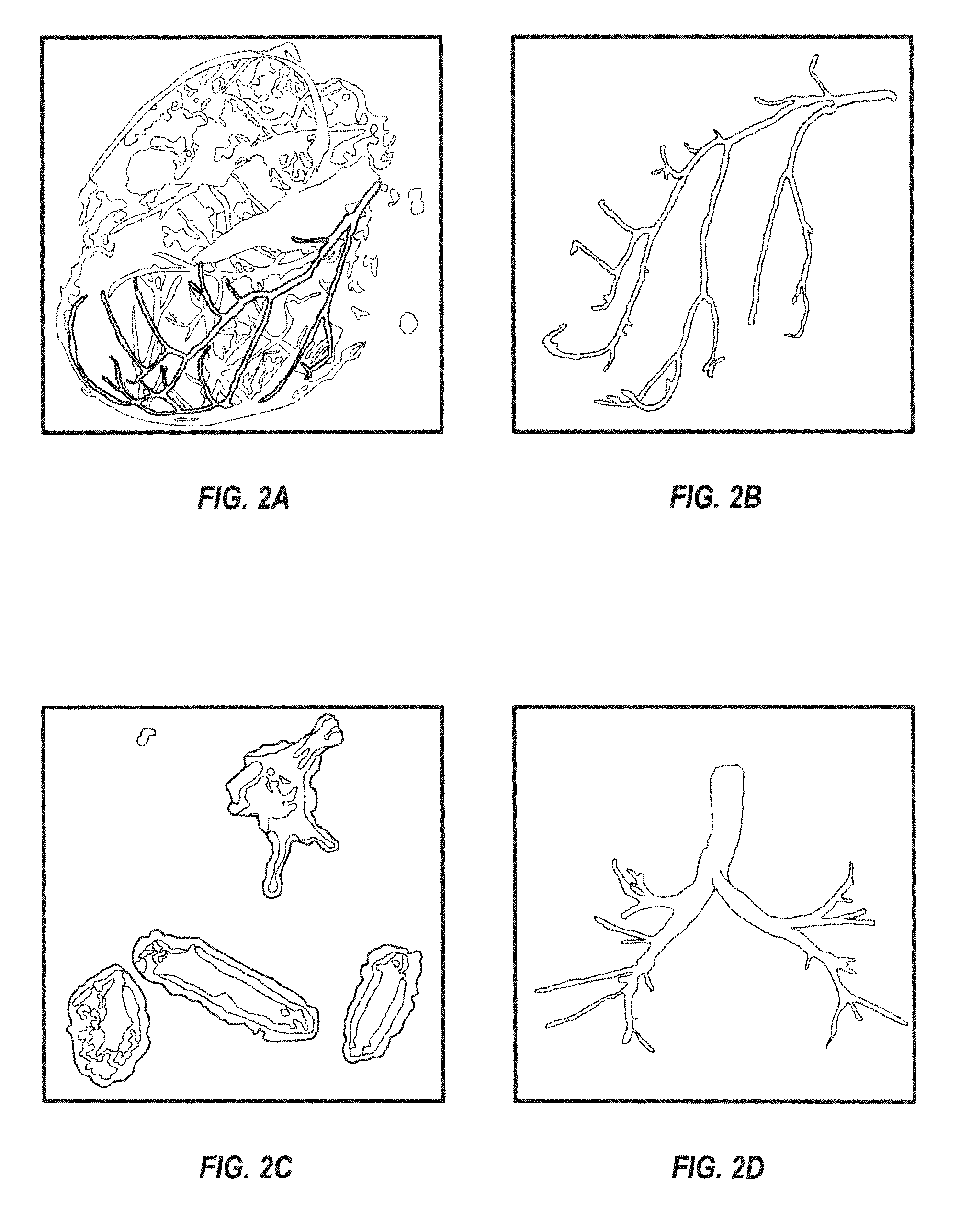 System and methods for multi-object multi-surface segmentation