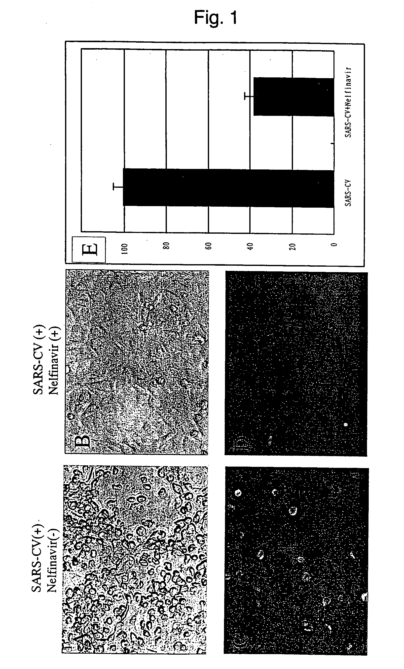 Anti-coronavirus drug