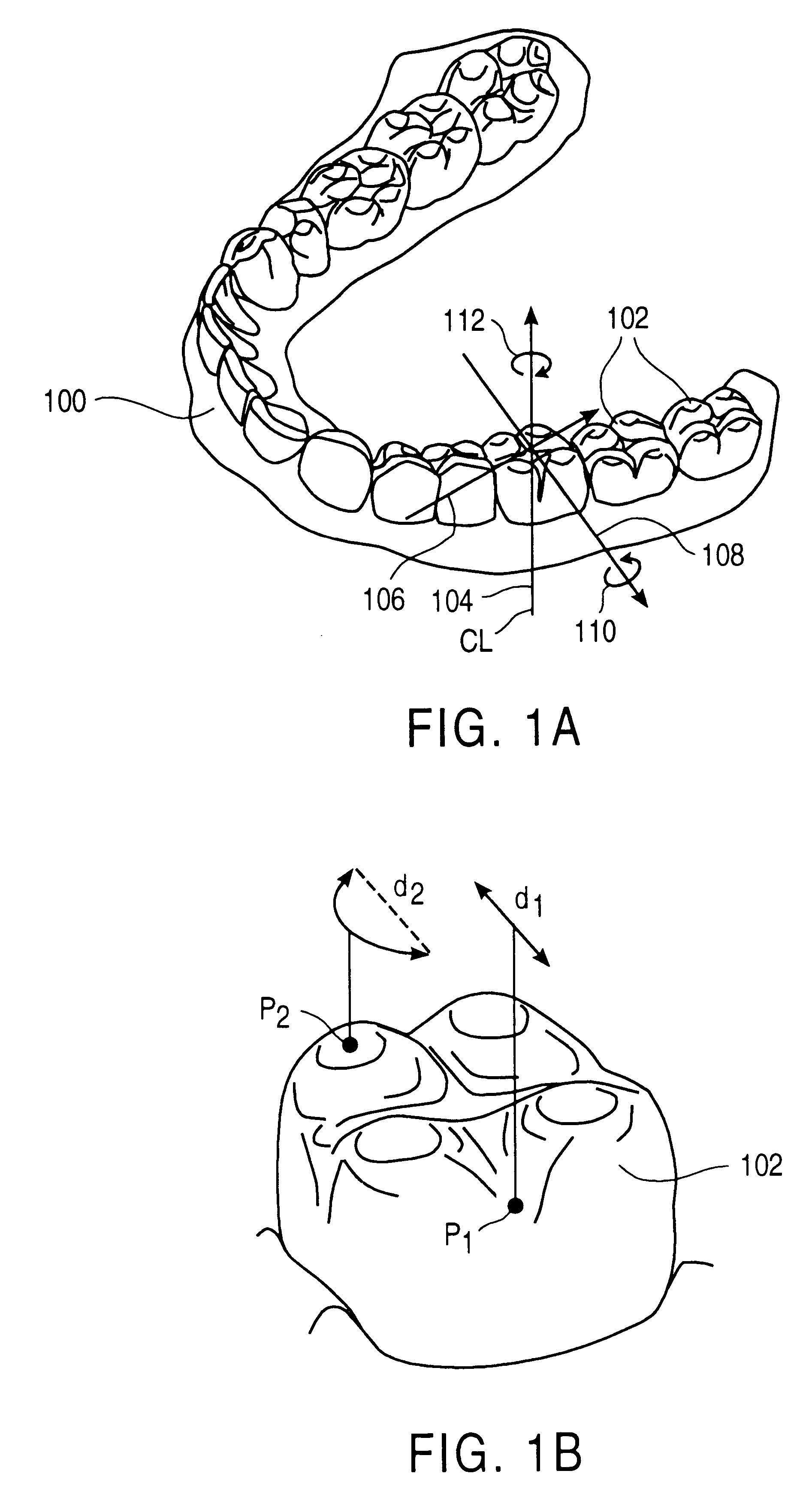 Method and system for incrementally moving teeth