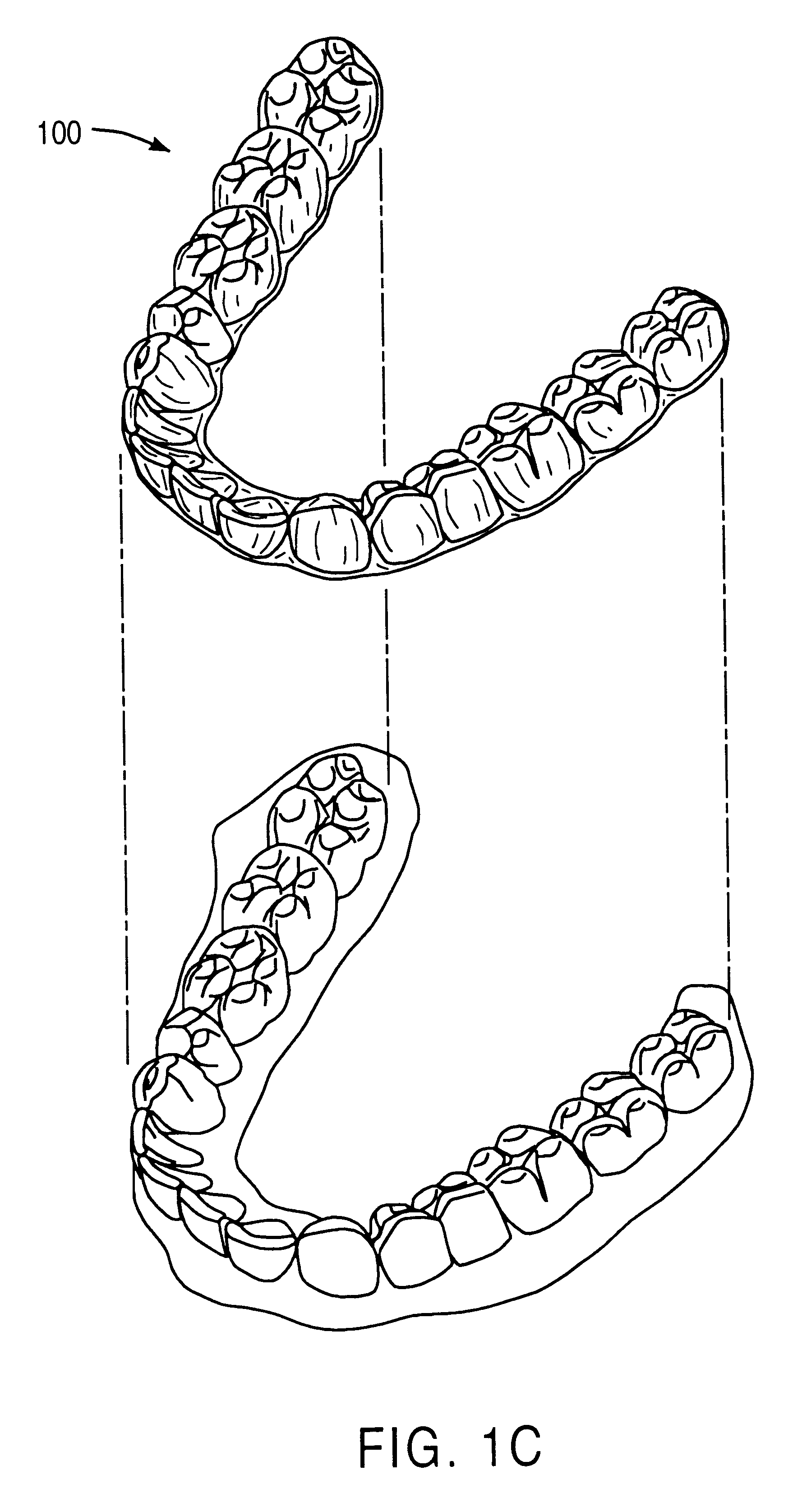 Method and system for incrementally moving teeth
