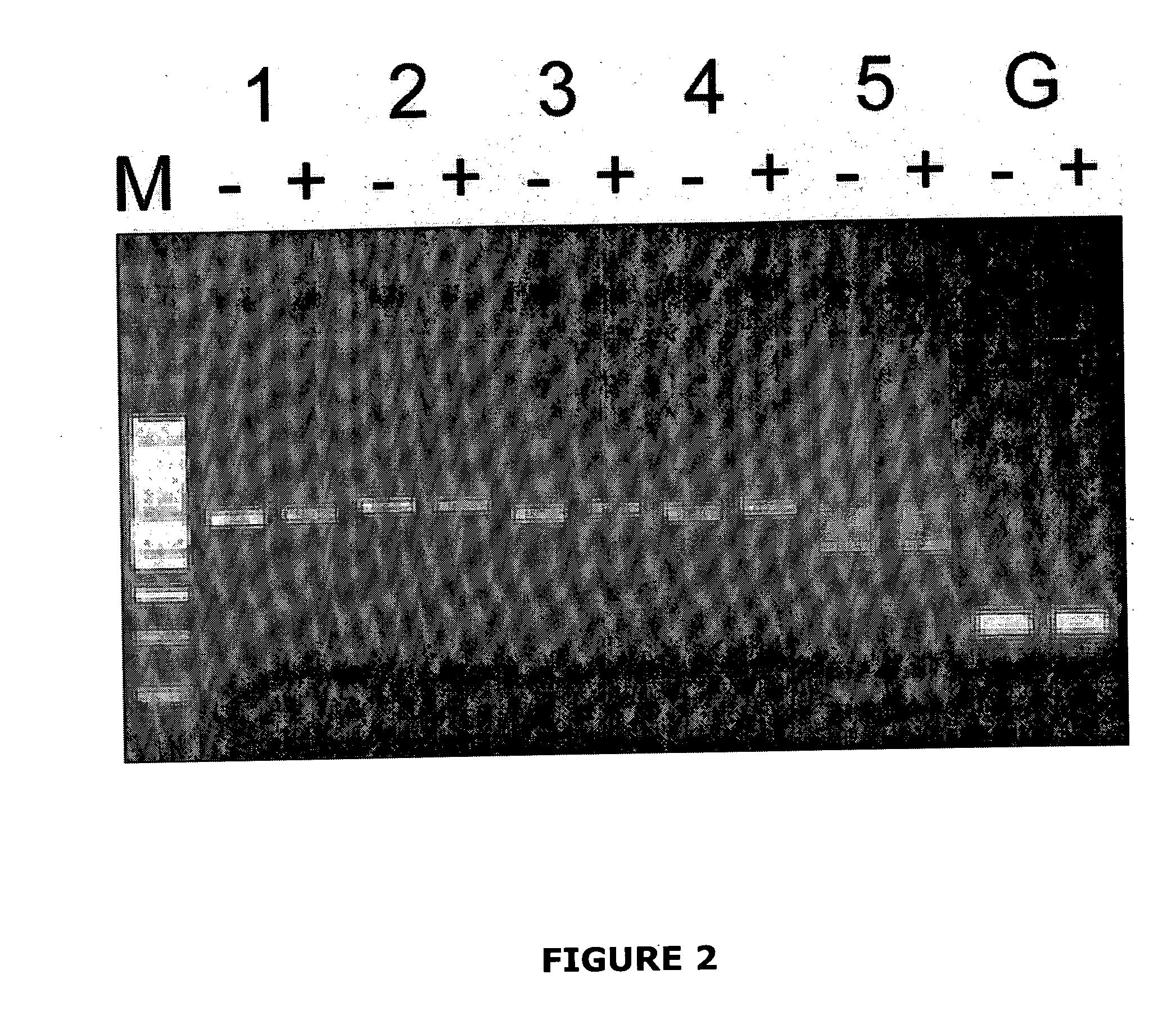 Nessie nucleic acids, polypeptides and mutations, and methods of use thereof
