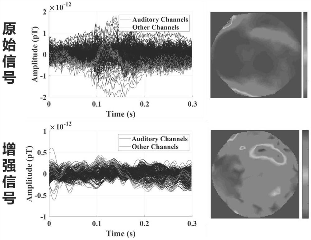 Magnetoencephalogram single auditory induction signal detection method and electronic device