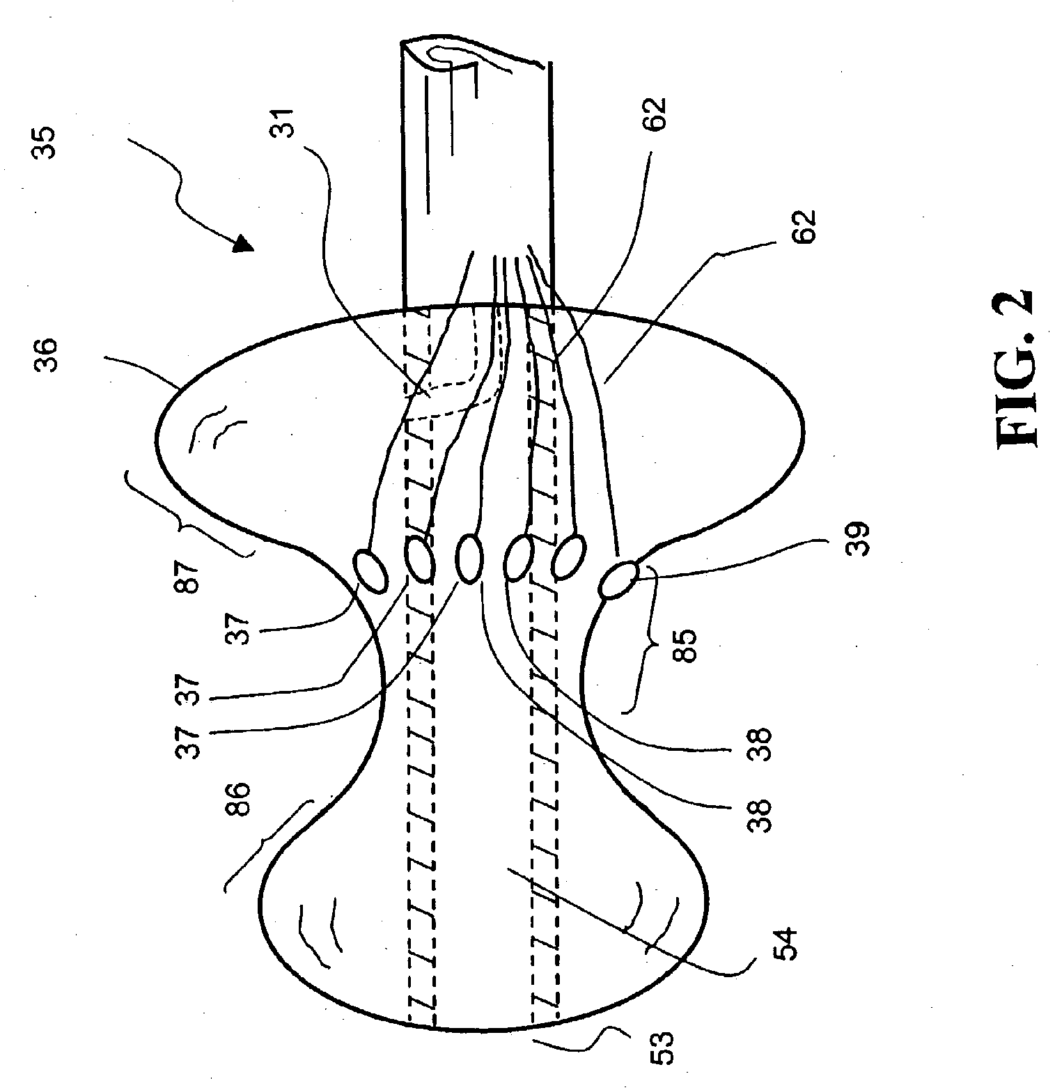 Method for treating and repairing mitral valve annulus