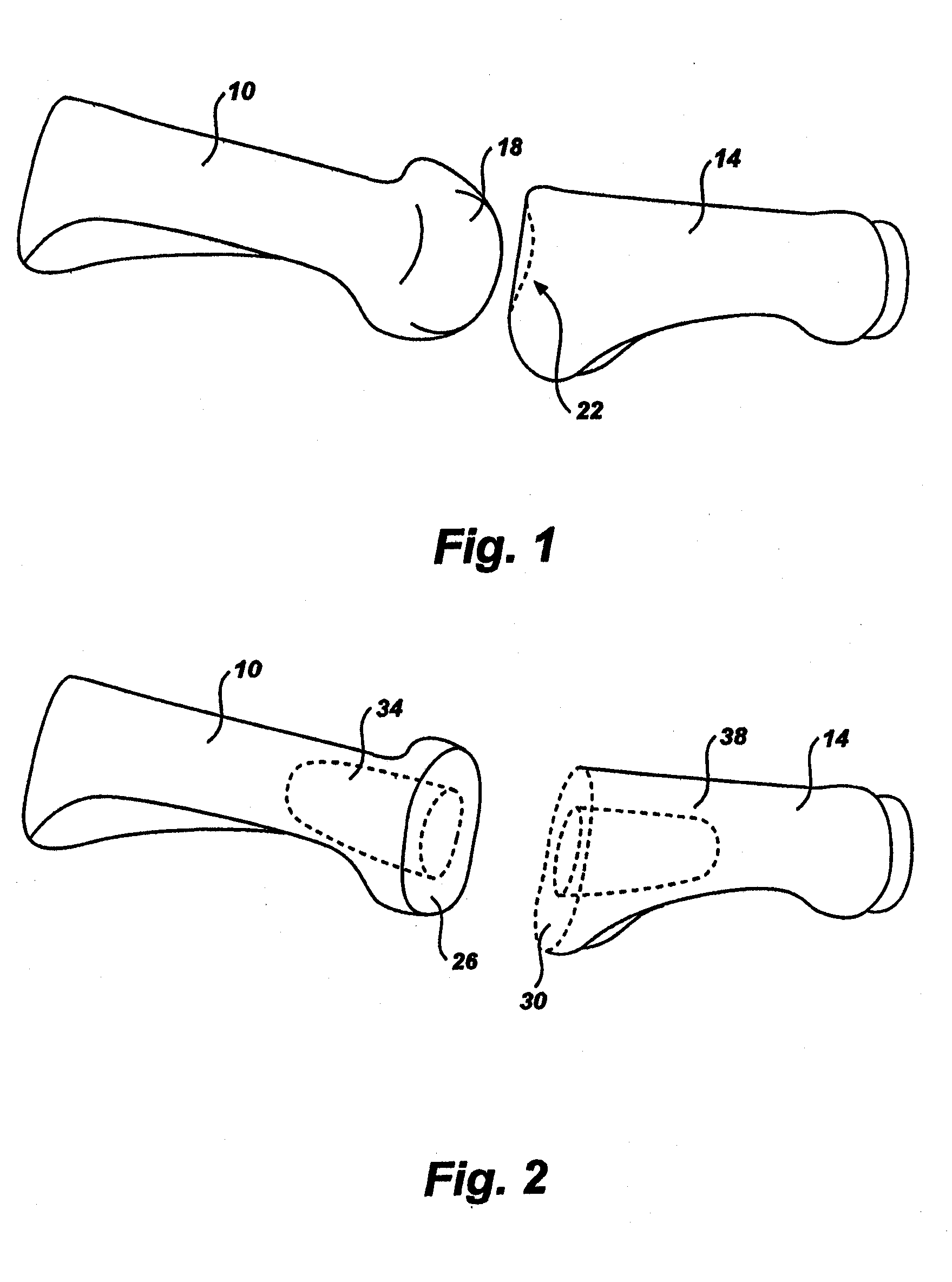 Artificial toe joint