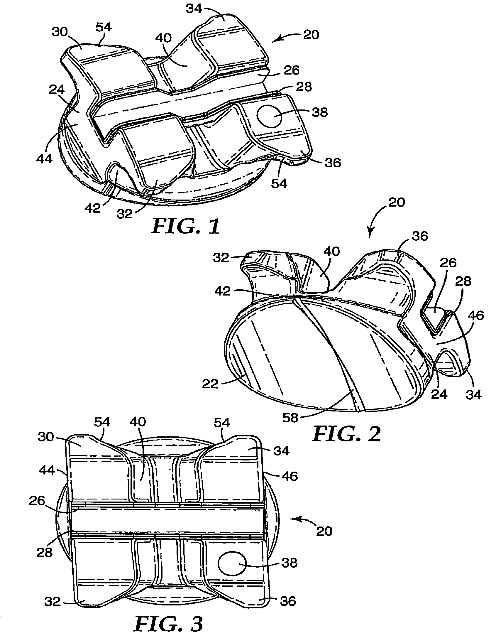 Orthodontic bracket with reinforced tiewings
