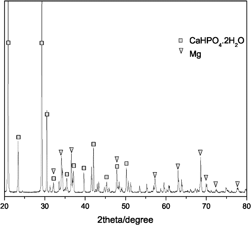 Method for preparing bioactive calcium phosphate coating on magnesium alloy surface for endosseous implant
