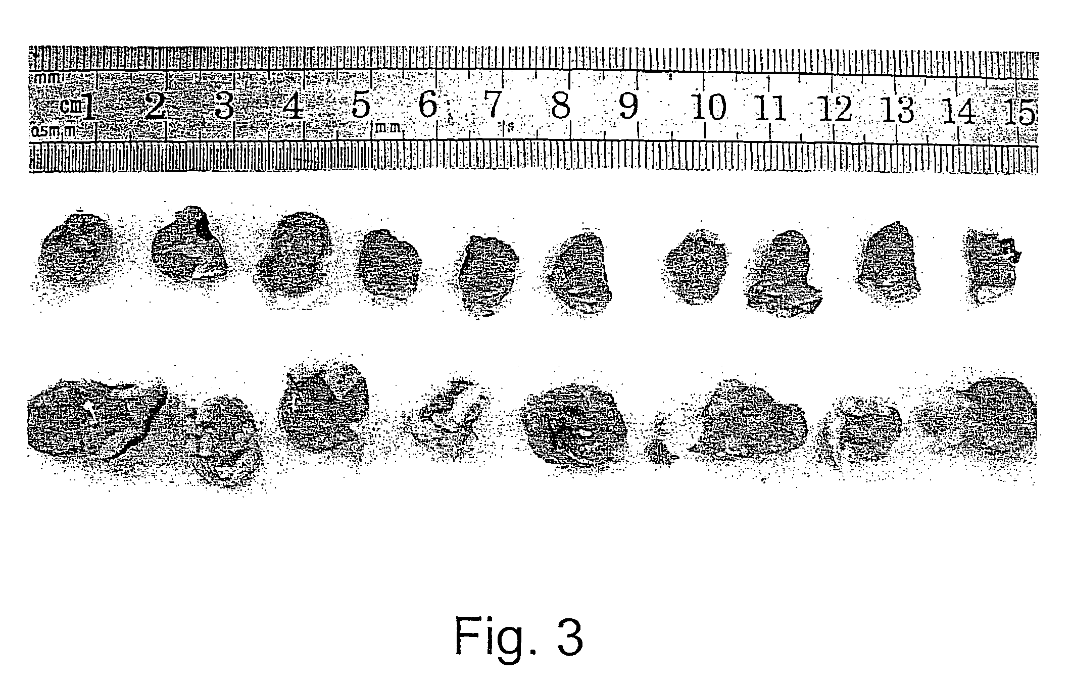 Methods and uses of leptin in immune modulation