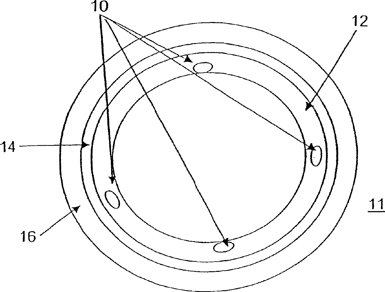 Bioactive bracket for type II diabetics