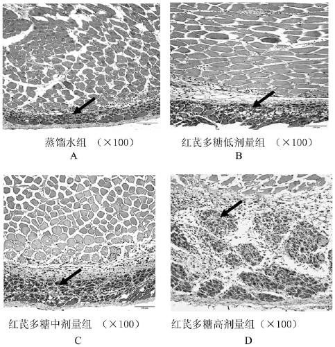 Use of Radix Astragali or Radix Radix Radix Polysaccharides for the Treatment of Ischemic Vascular Diseases