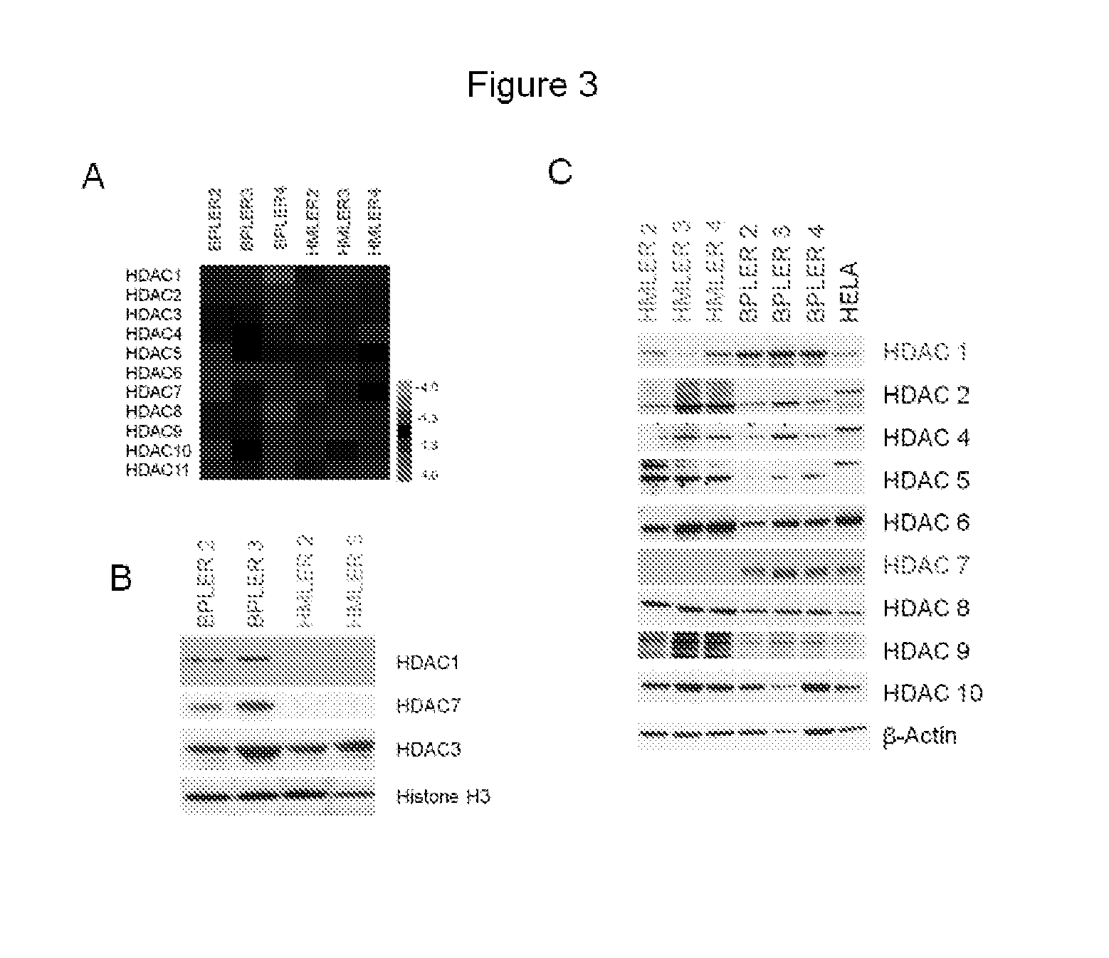 Markers for and methods of targeting tumor stem cells