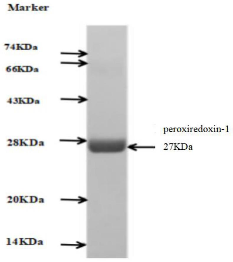 Kit for detecting anti-peroxide reductase 1-IgG antibody