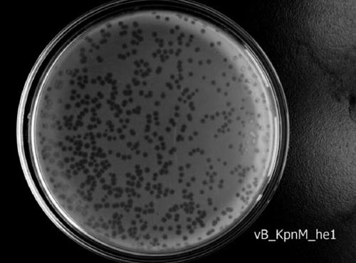 A kind of Klebsiella pneumoniae phage and its application