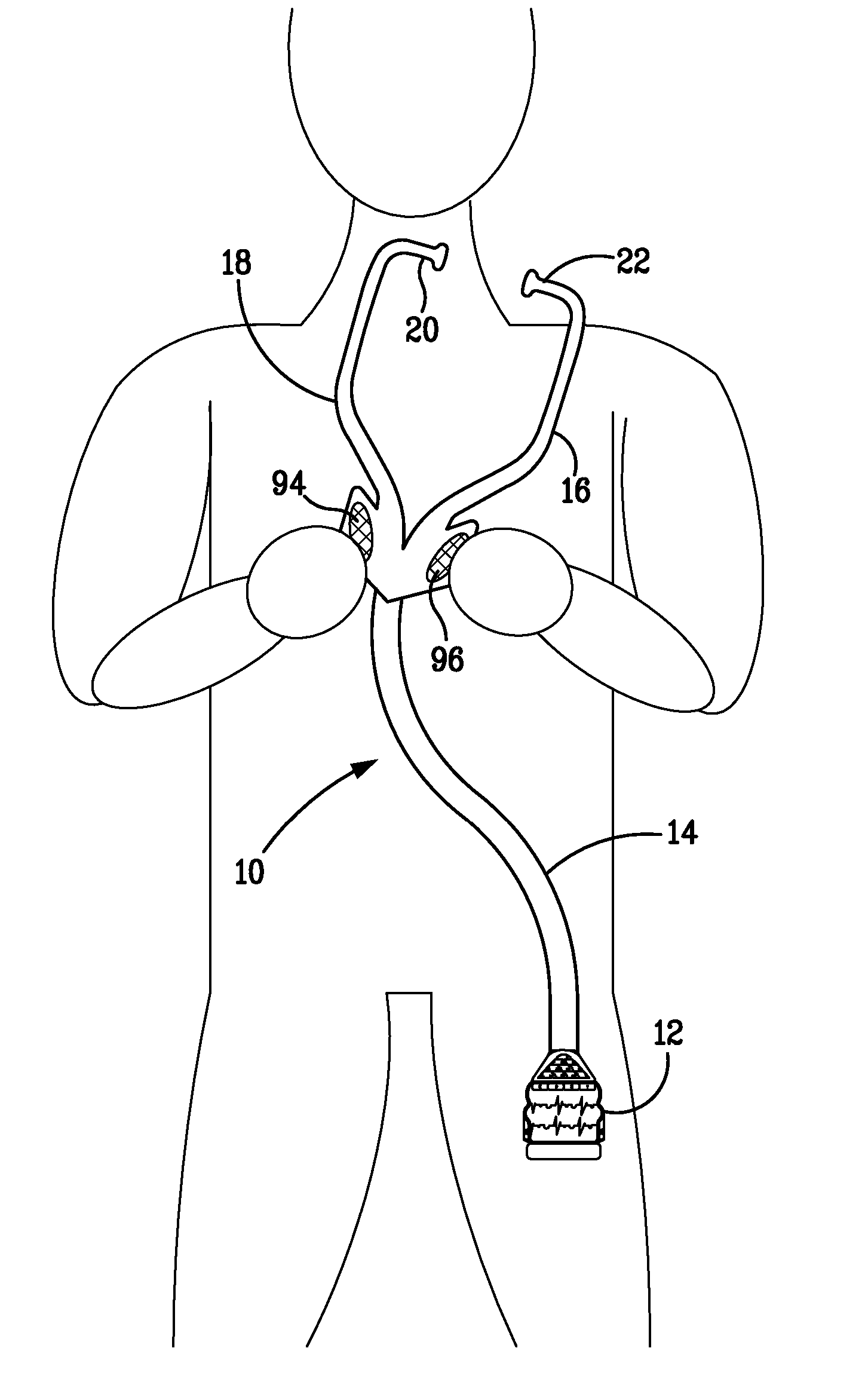 Medical examination apparatus