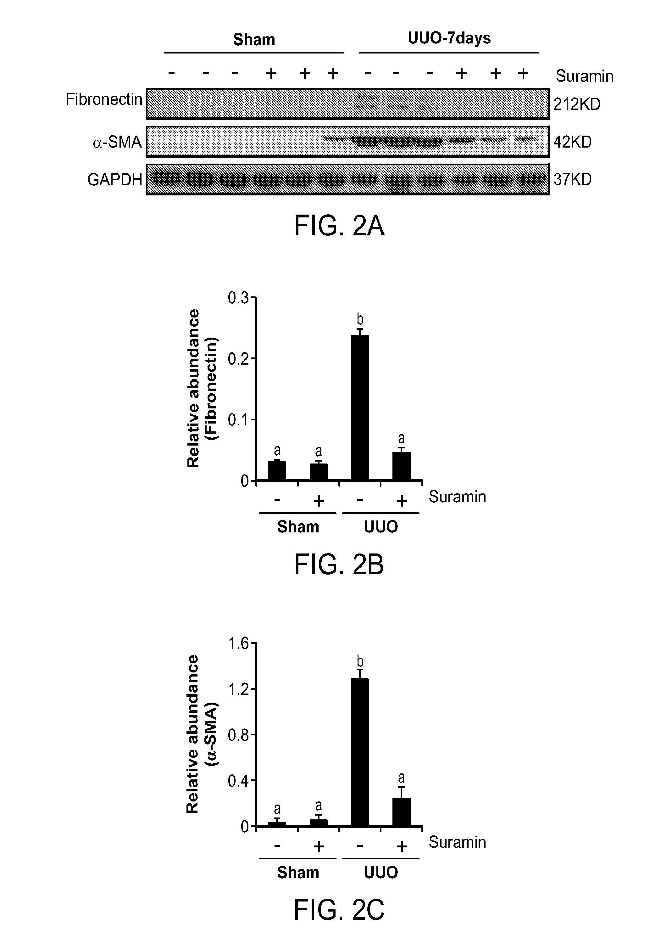 Inhibition of Renal Fibrosis