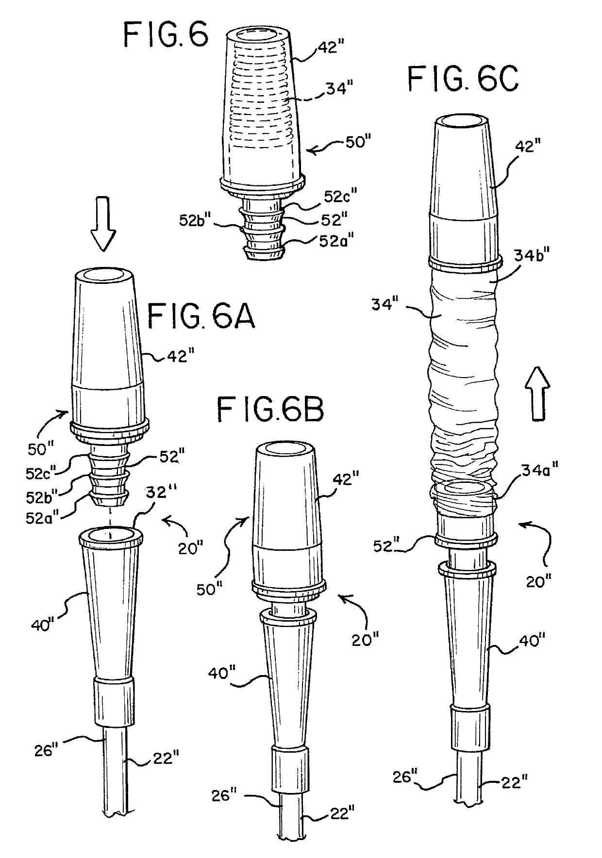 Intermittent urinary catheter assembly and an adapter assembly for an intermittent urinary catheter