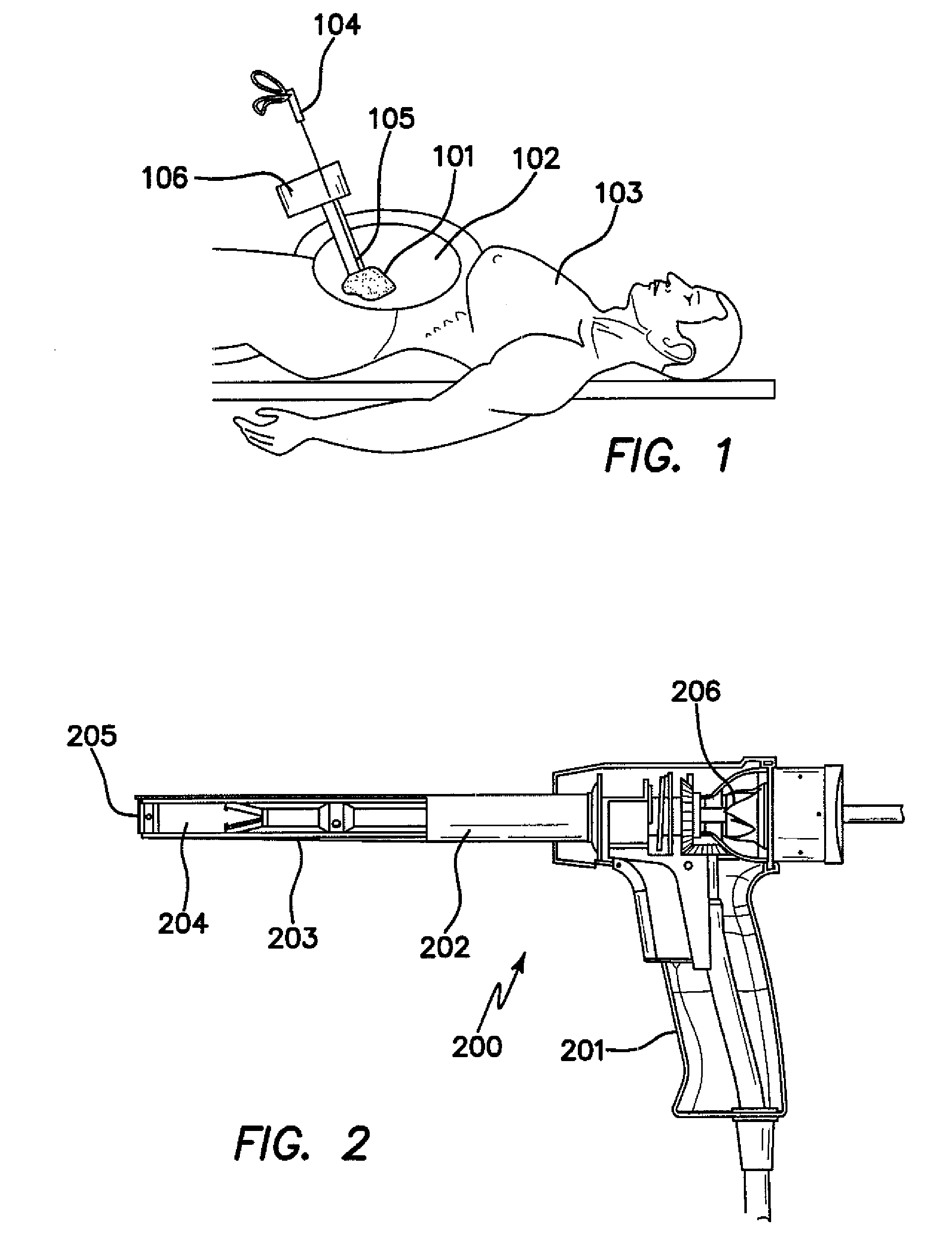 Method and apparatus for tissue morcellation