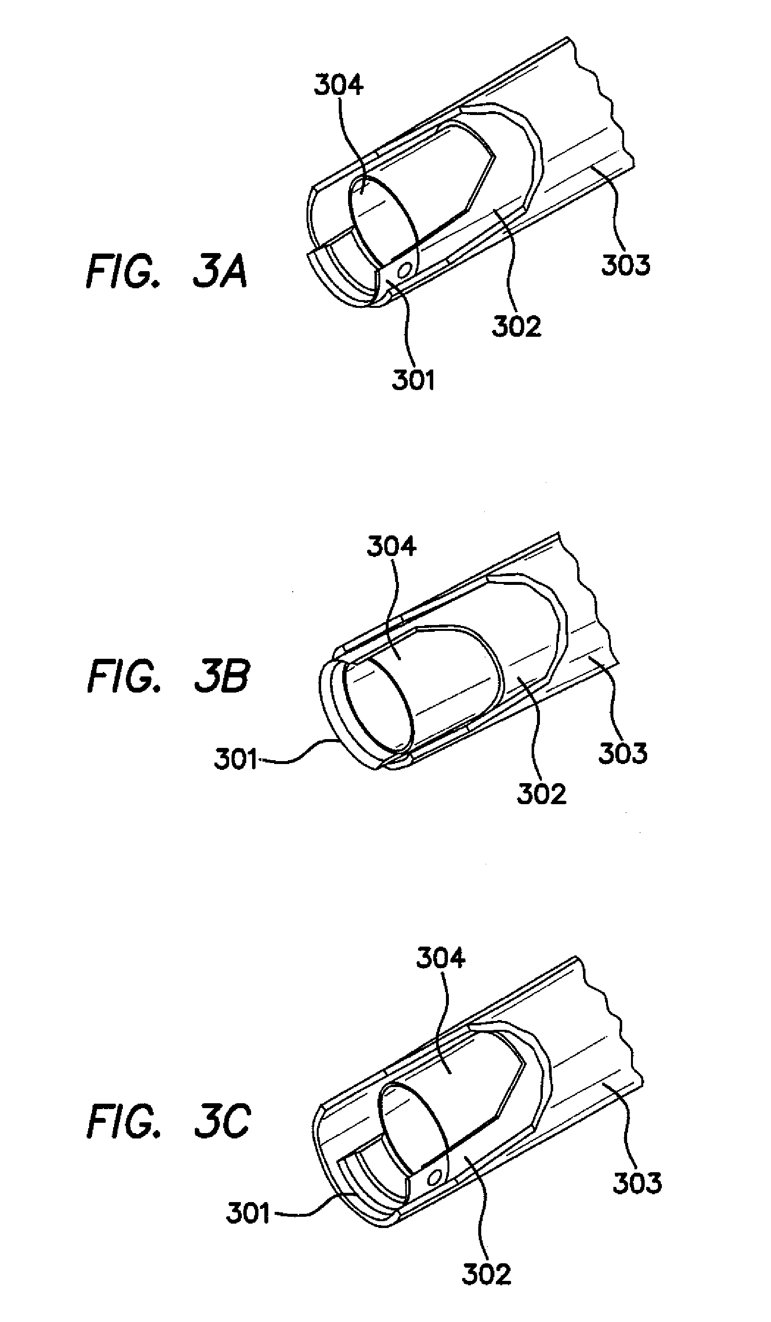 Method and apparatus for tissue morcellation