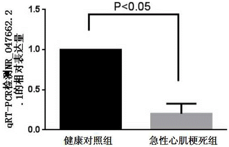 NR-047662.2 and in-vitro detection reagent, preparation or kit, applications and detection method