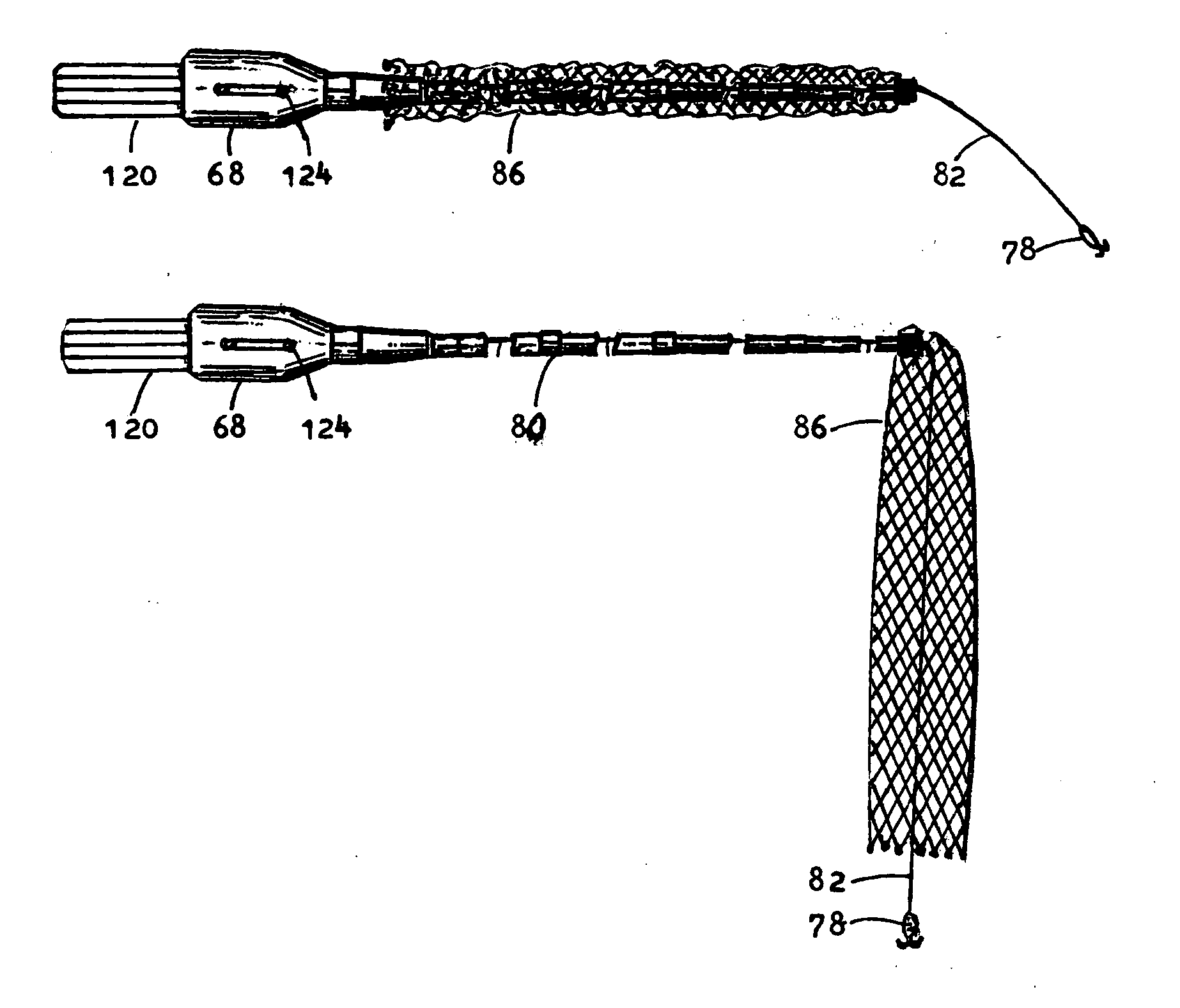 Methods and devices of the net apparatus, the fishing rod and the spinning mechanism combination