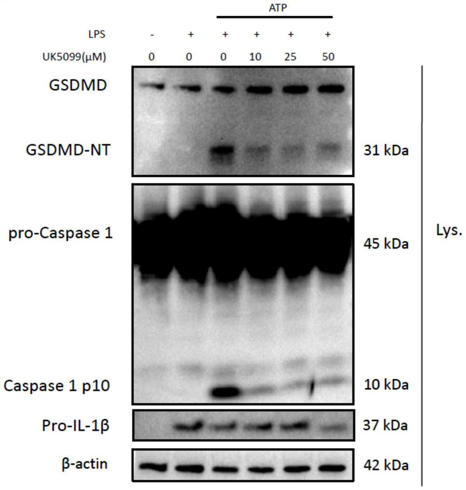 NLRP3 inhibitor