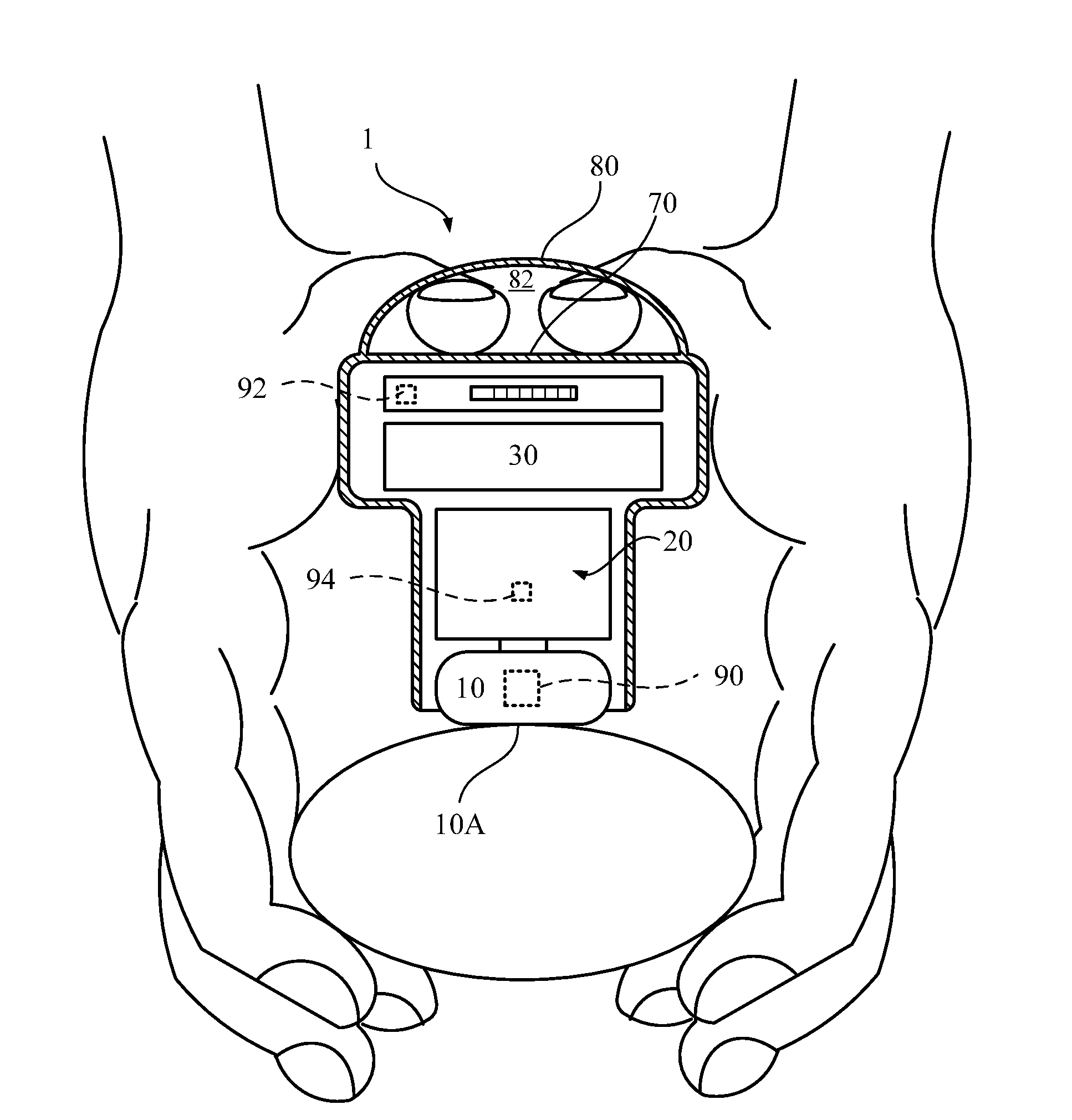 Automatic chest compression device