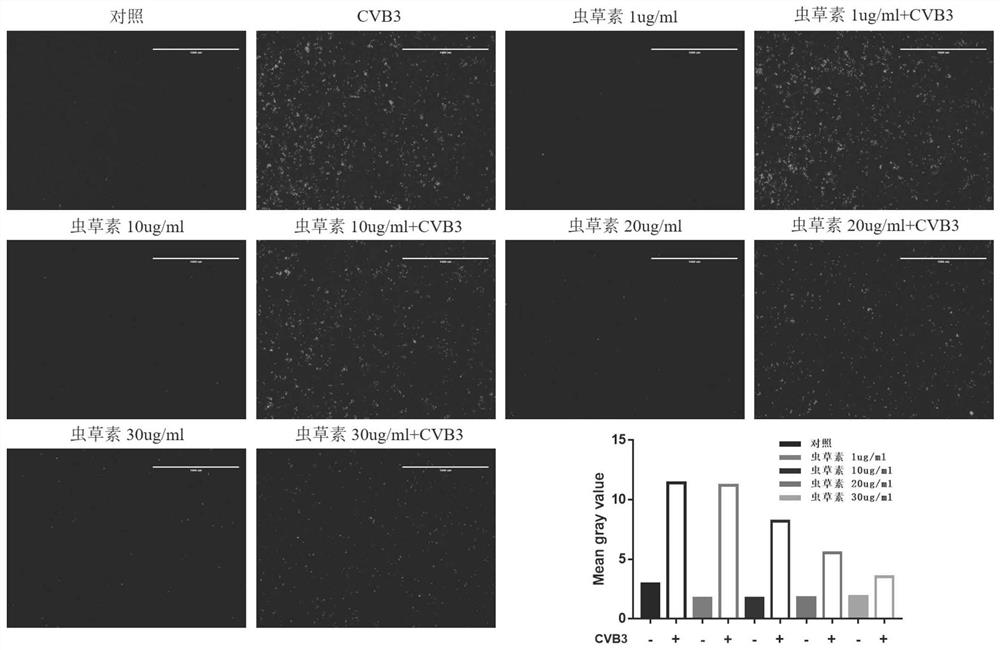 Application of cordyceps militaris pharmaceutical composition in preparation of preparation for preventing and/or treating novel coronaviruses and resisting respiratory viruses